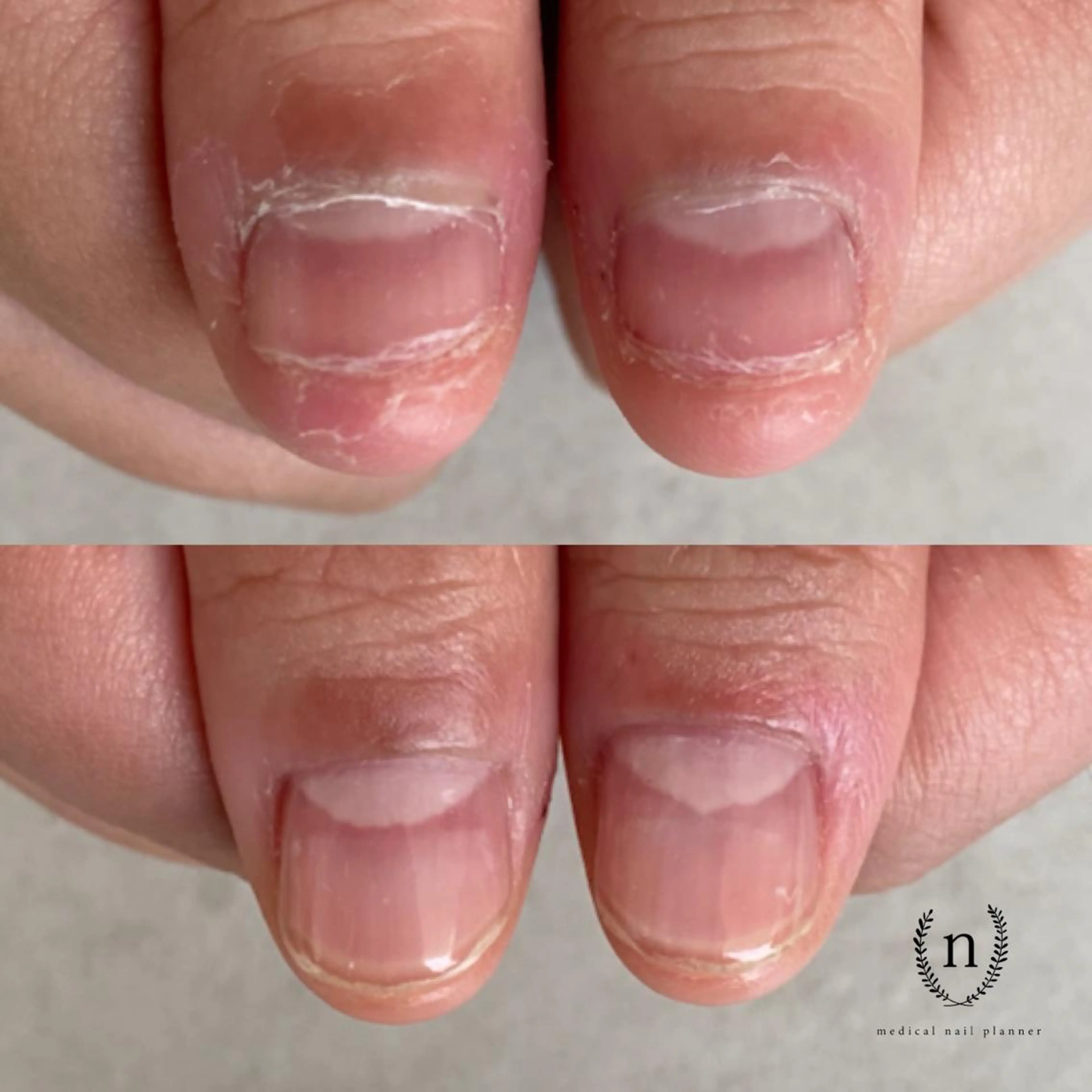 ネイル Rio 𓍼のネイルデザイン