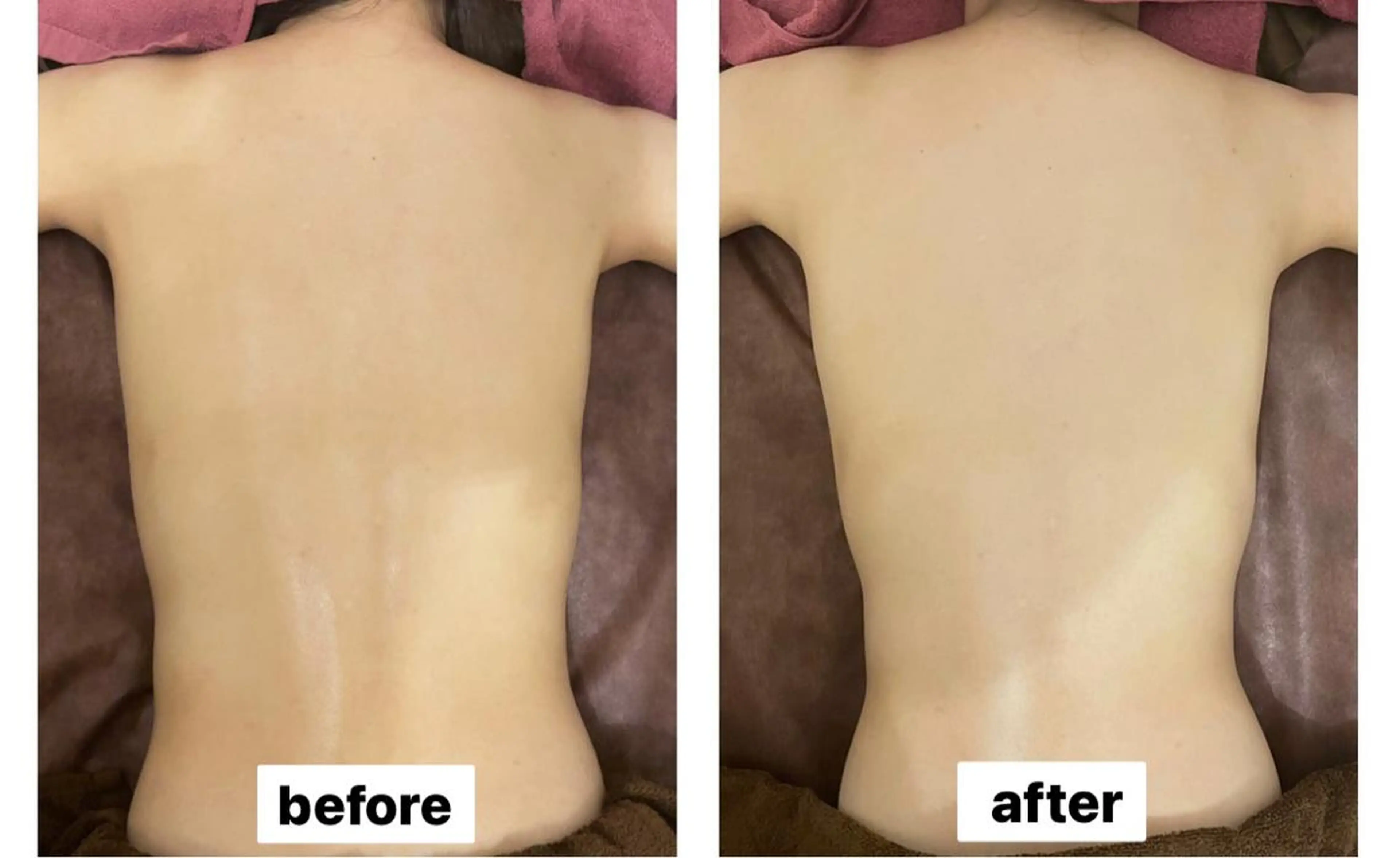 35歳からの エイジングケアサロンのエステ・リラクイメージ