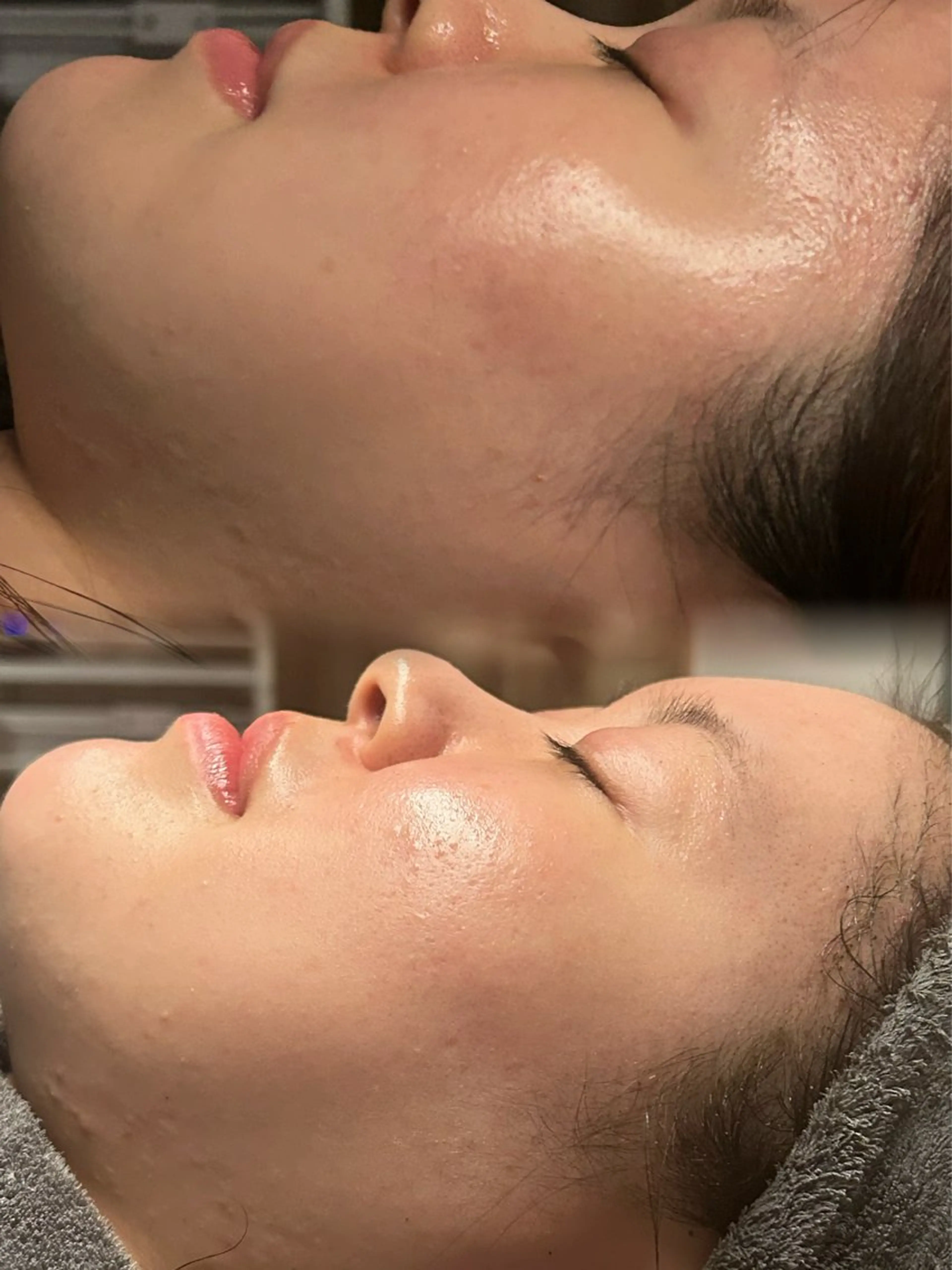 エステ Smoo アユミの眉毛・アイブロウイメージ