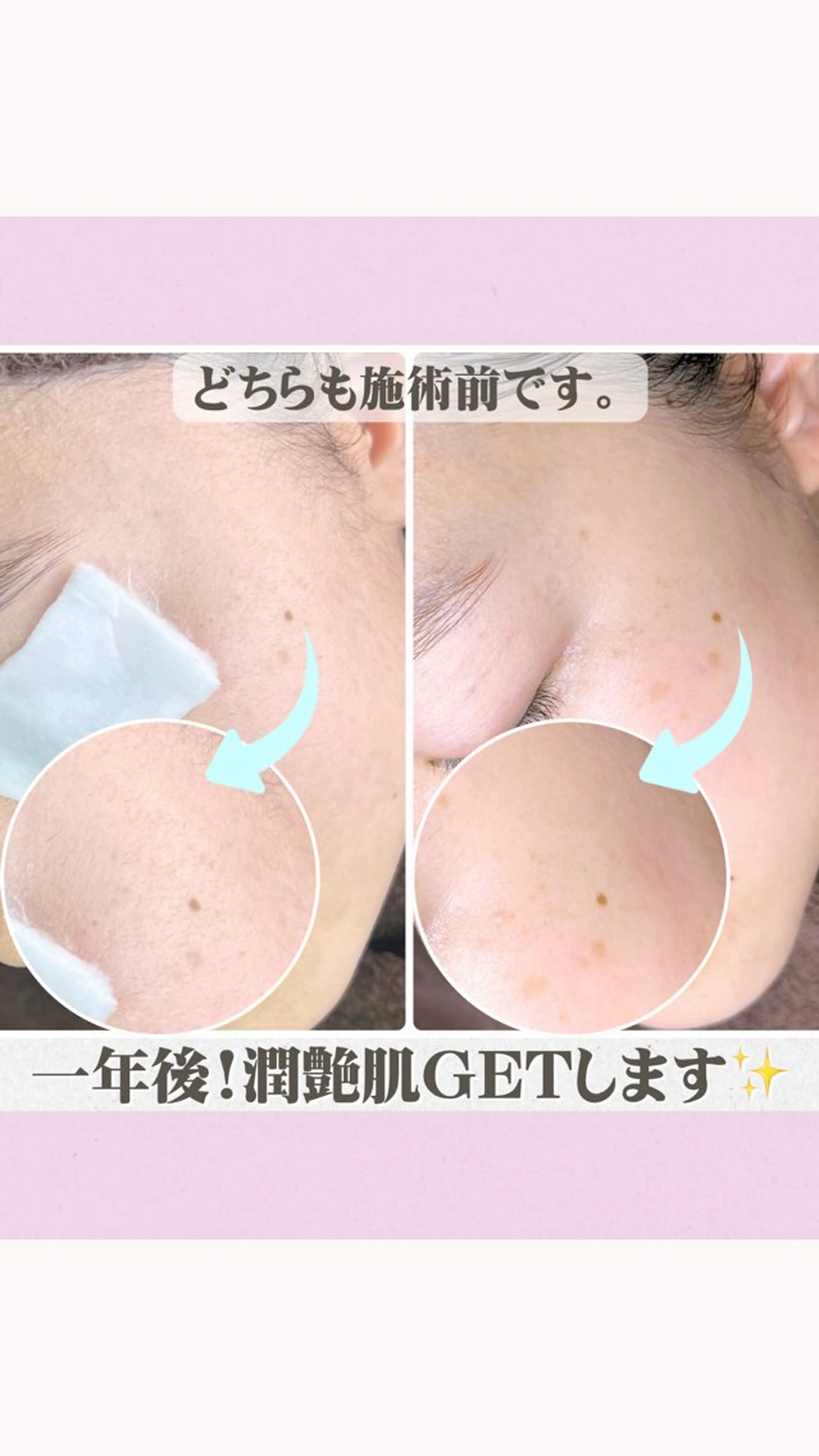 脱毛 Muqu.所属・Muqu. 毛穴サロンのエステ・リラクイメージ