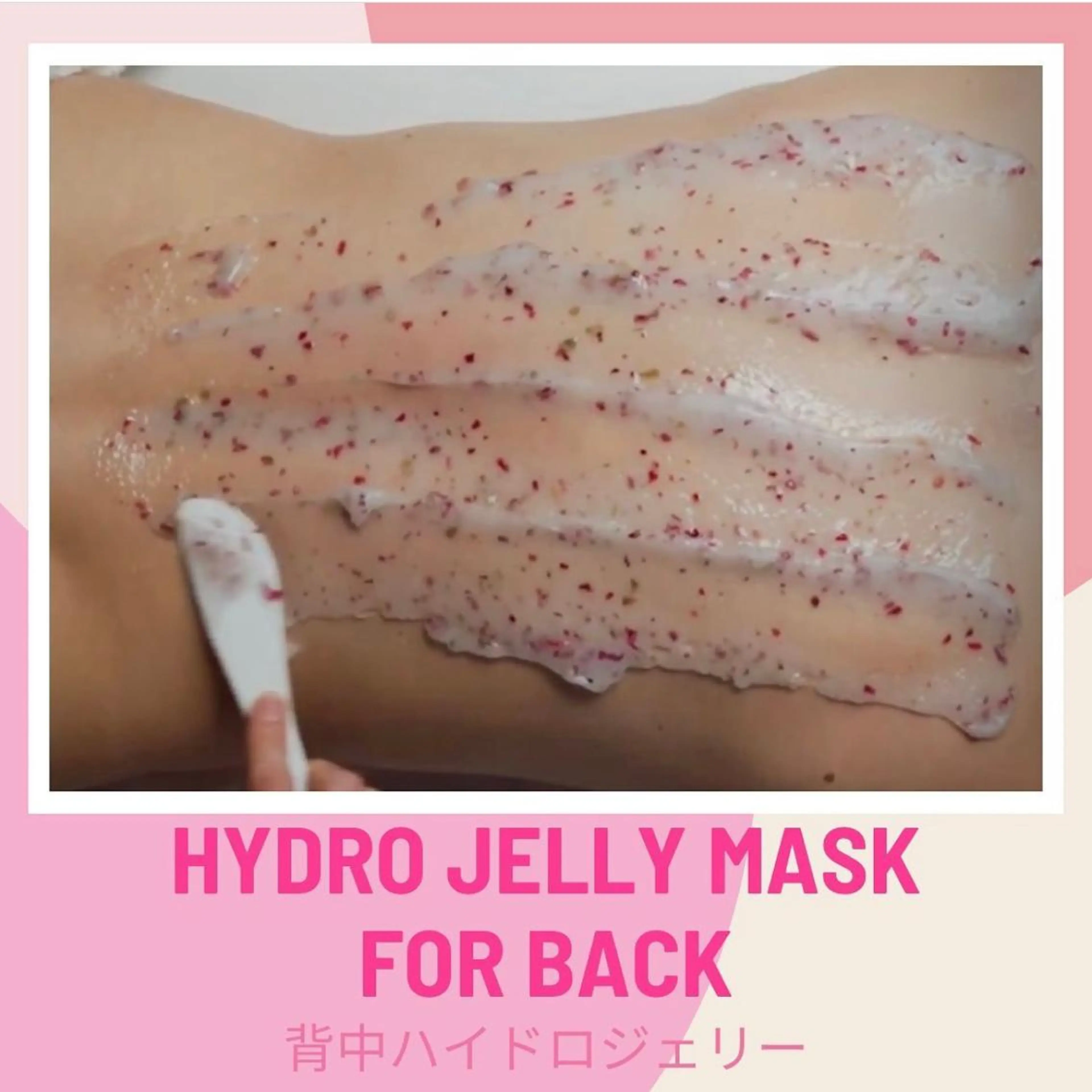 海外セレブや世界中の美容外科、クリニック等で取り扱いされてる話題の肌再生パック!背中ケアコースの写真