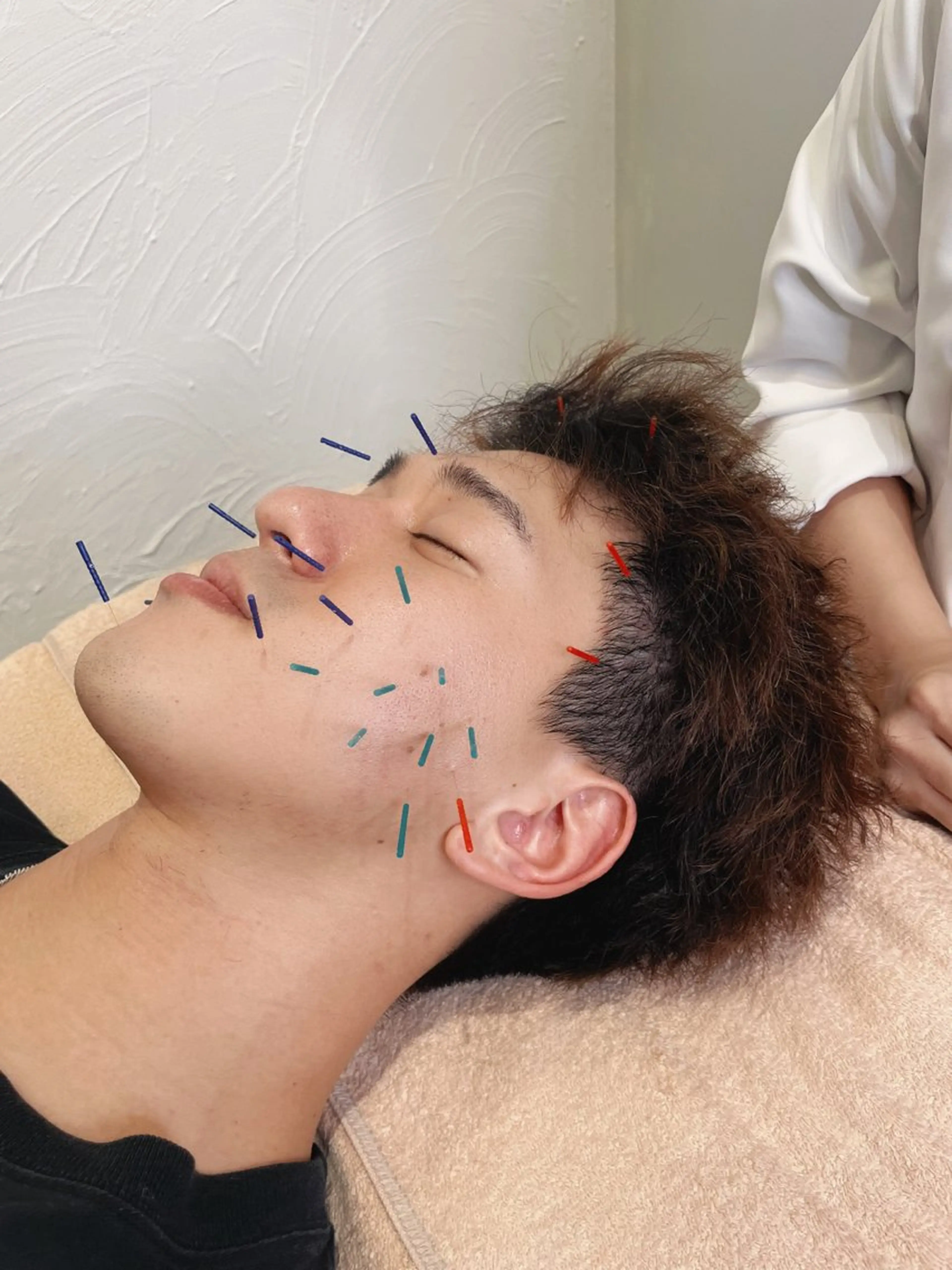 メンズ 🌸美容鍼サロン🌸 メゾンブランシェ🌈のエステ・リラクイメージ