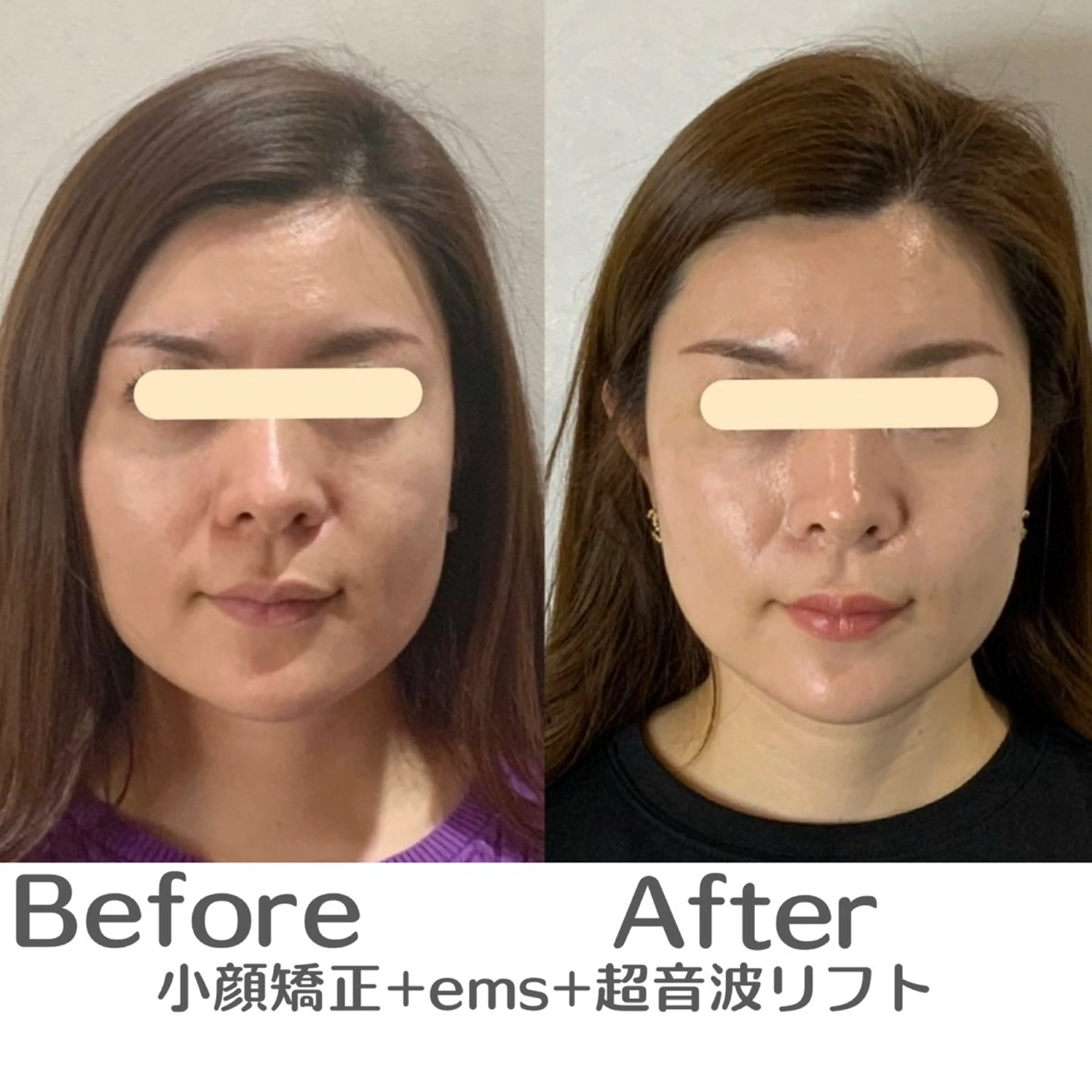 エステ リラク 最速小顔・肌質管理 espoirマキのエステ・リラクイメージ