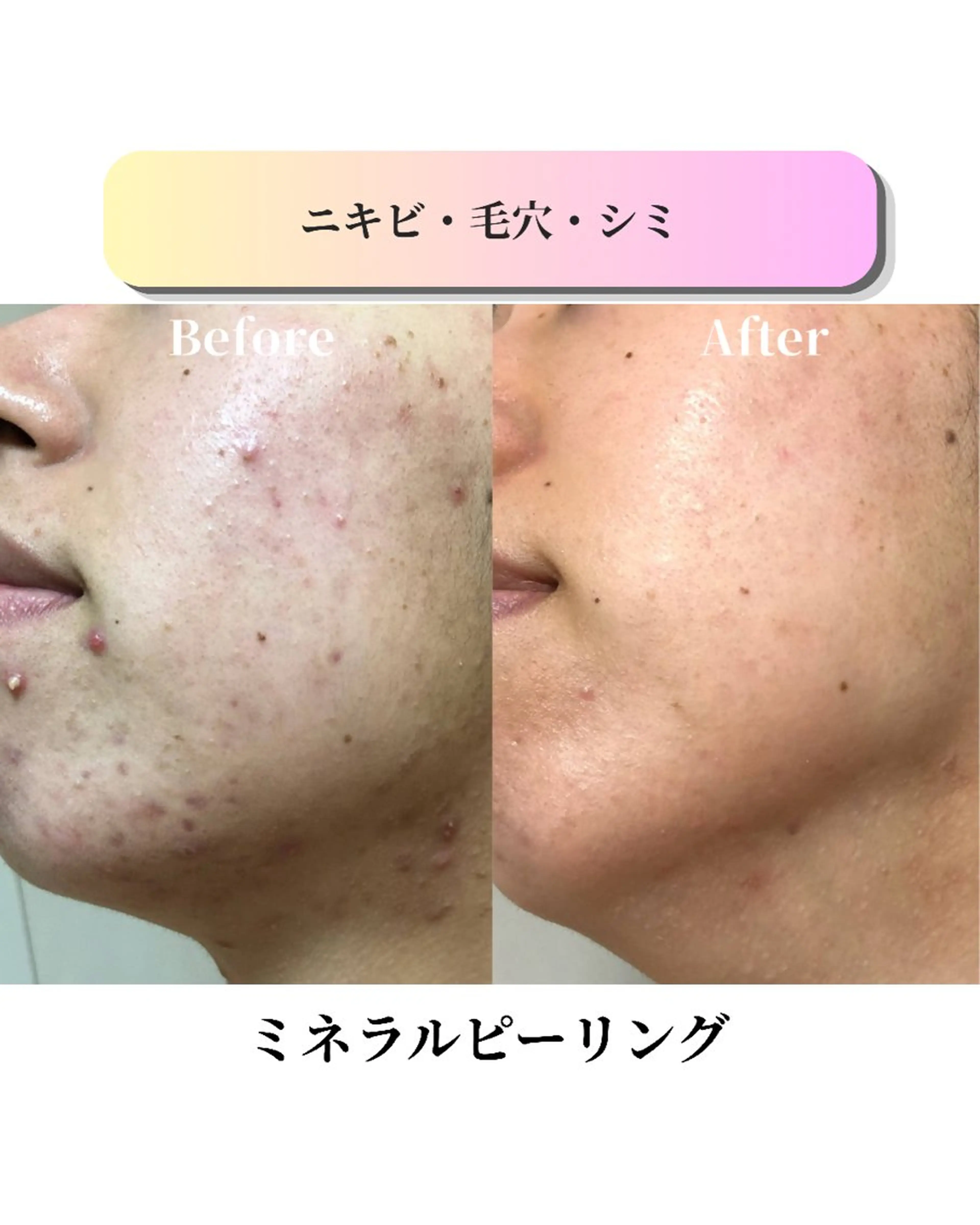 エステ ローズフィールド 森岡朋美のエステ・リラクイメージ