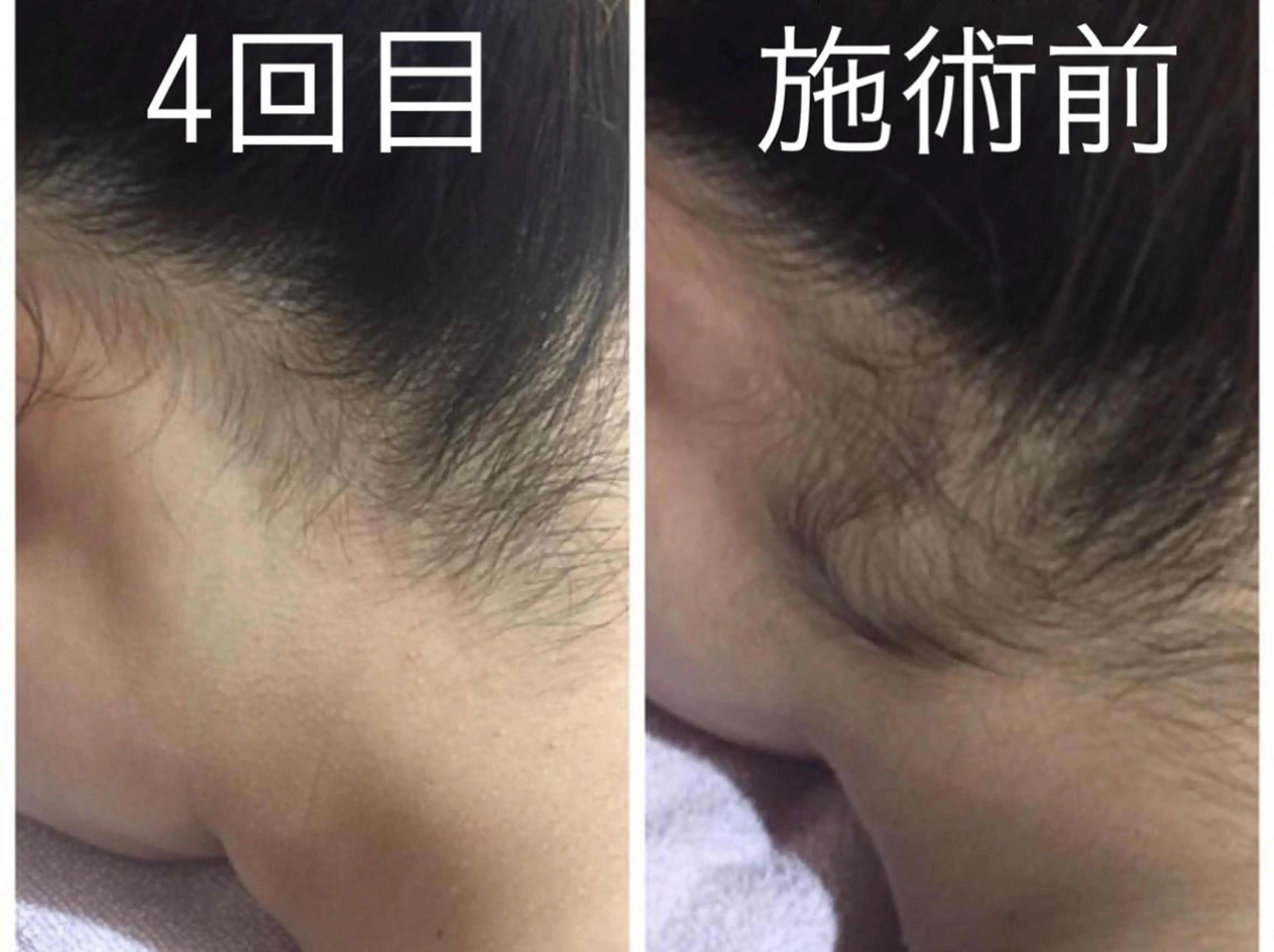 【うなじ・背中上】気になる後ろ姿の写真