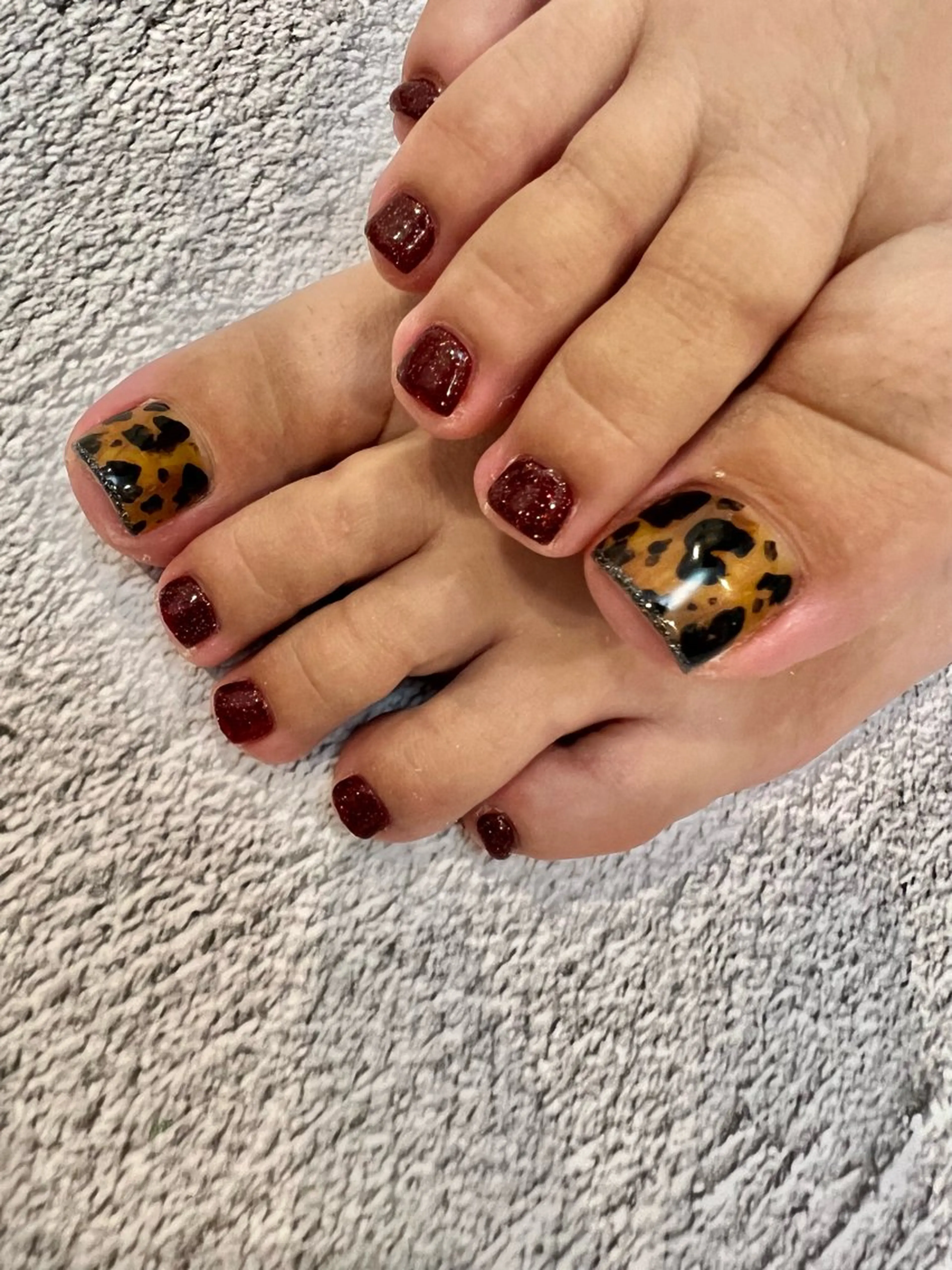 フット10本やり放題の写真