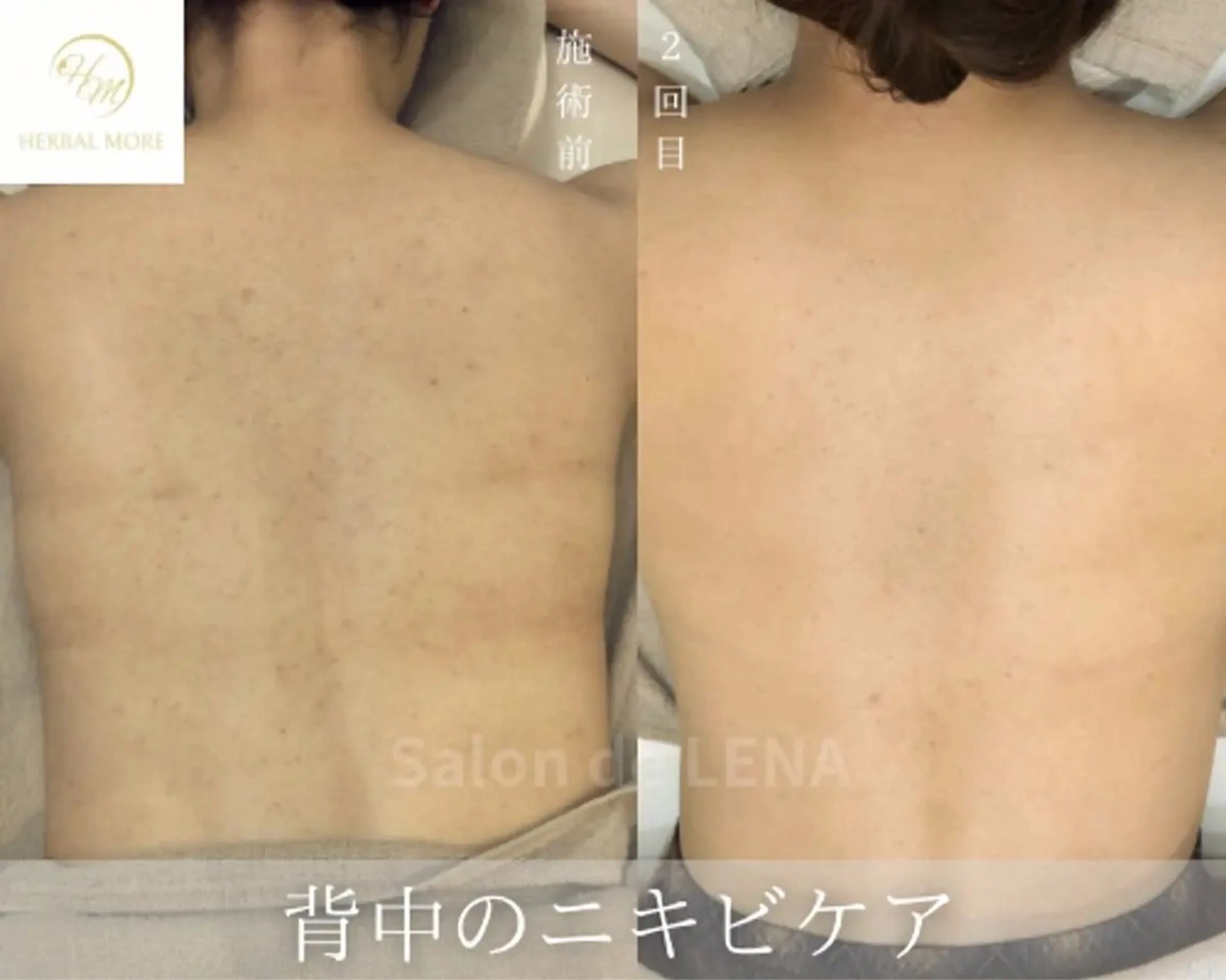 ハーブピーリング専門 グランディール　武内のエステ・リラクイメージ