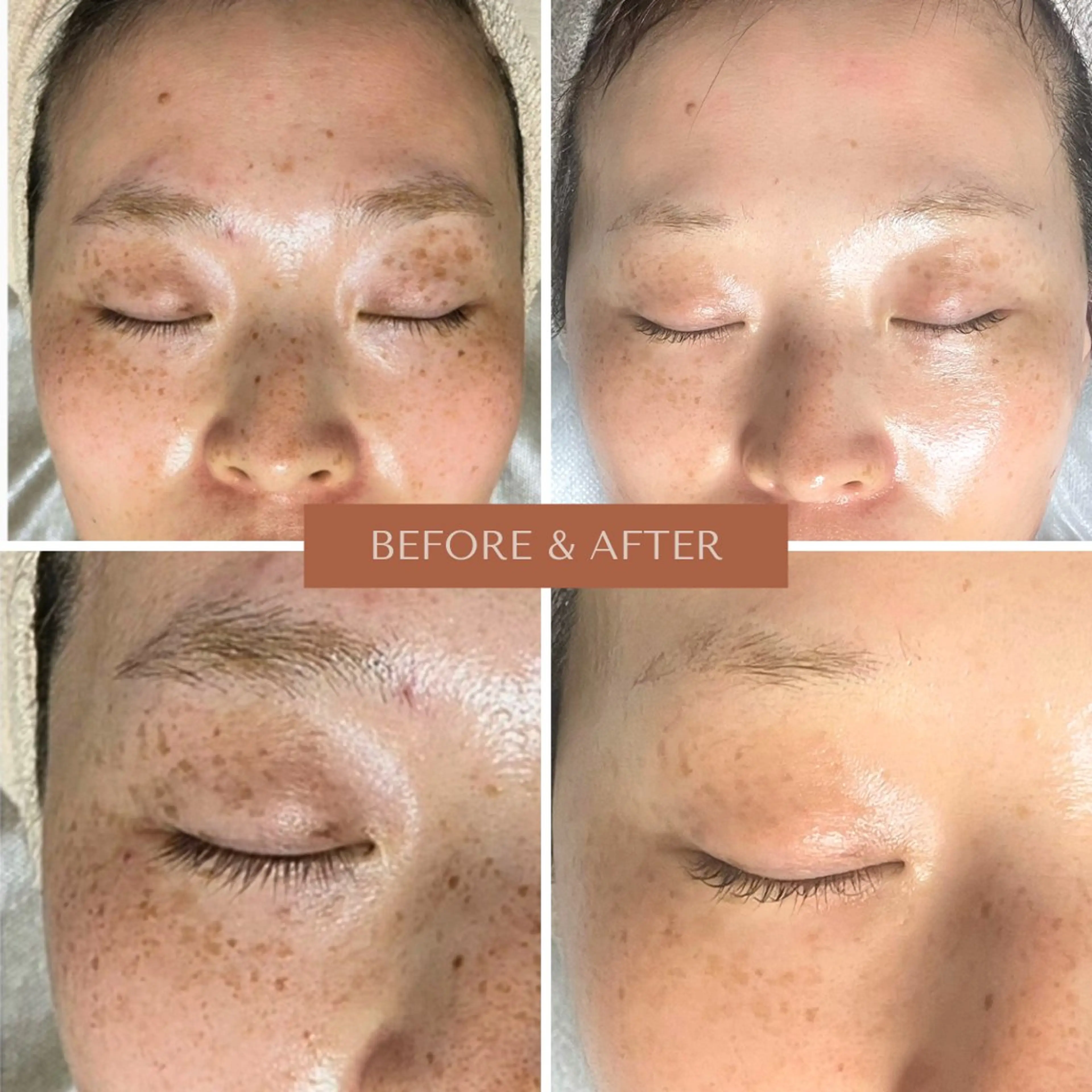 エステ リラク 脱毛増毛肌管理サロン Jemoのエステ・リラクイメージ