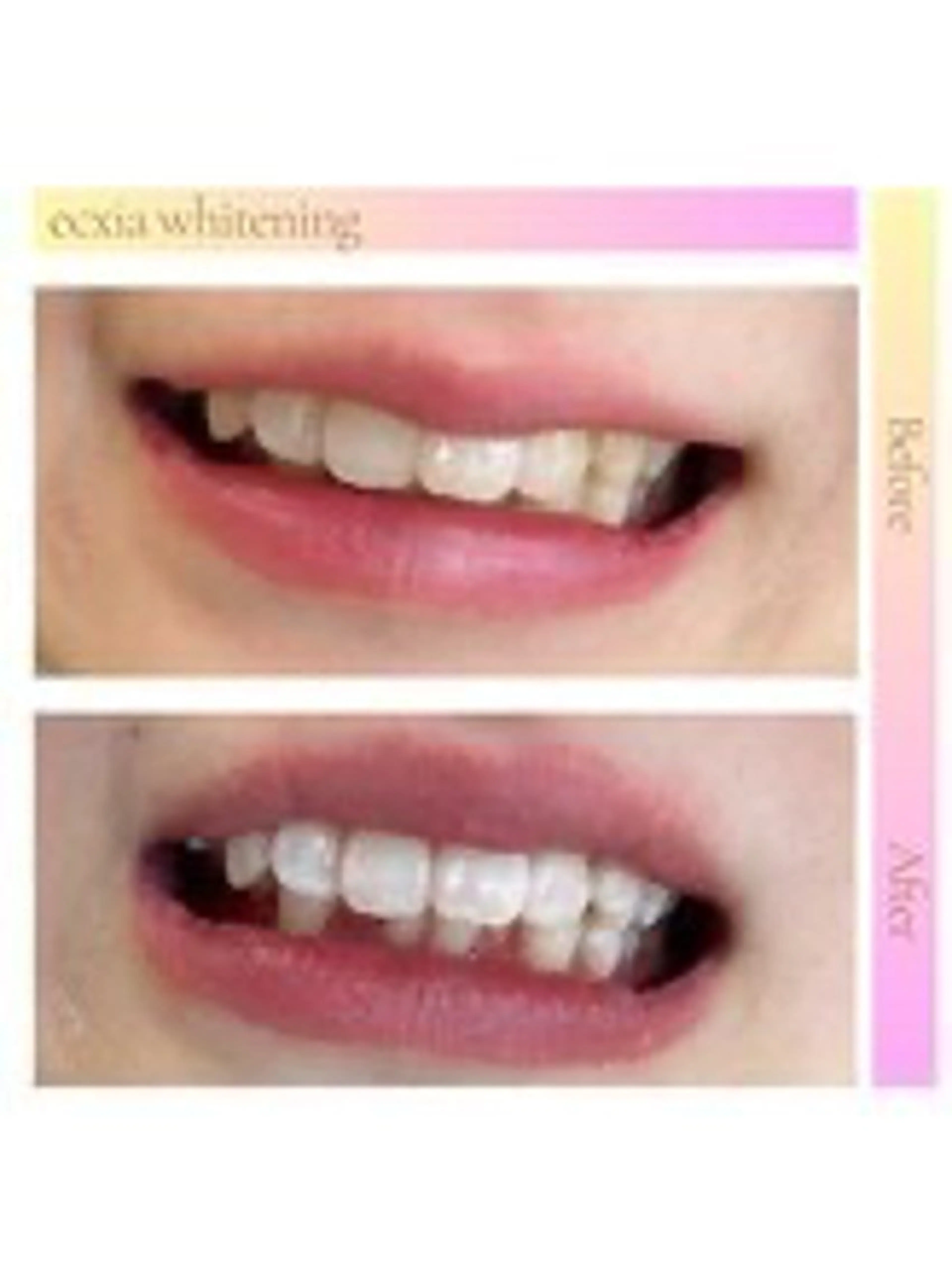 セルフホワイトニング エクシア西宮北口店のその他イメージ