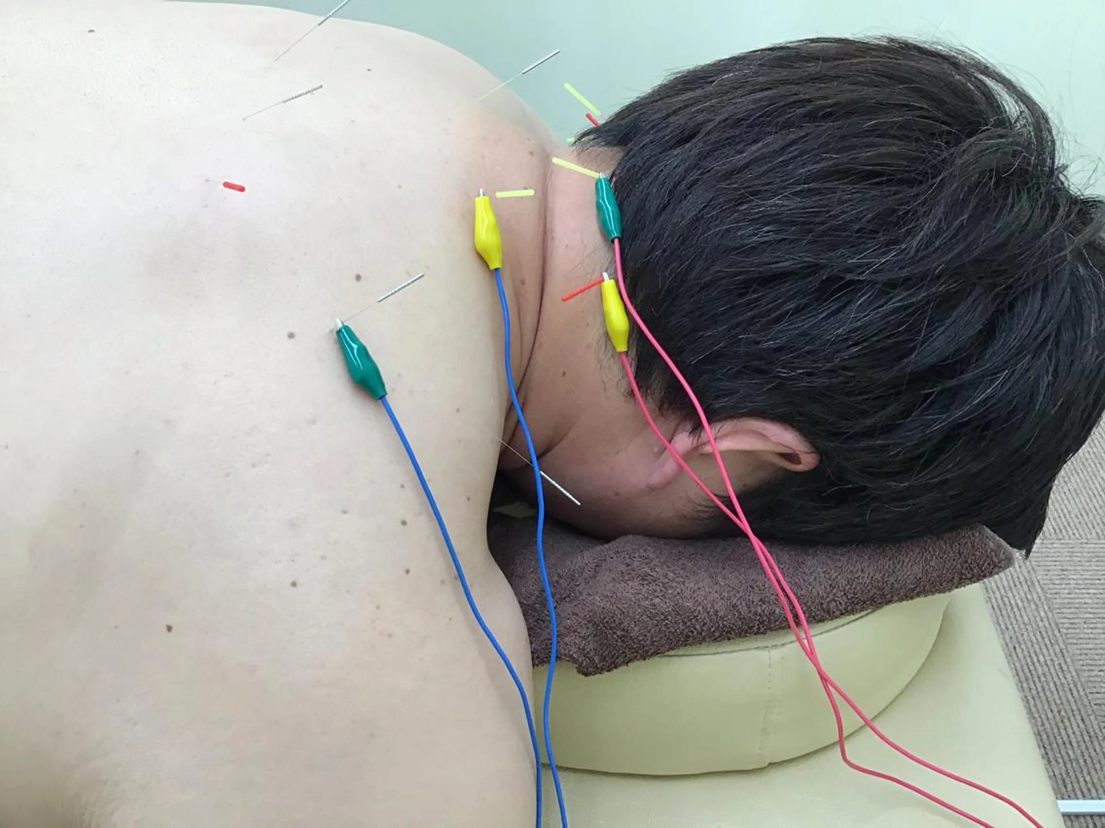 まごころ鍼灸整骨院所属・まごころ鍼灸整骨院 京王堀之内院のエステ・リラクイメージ