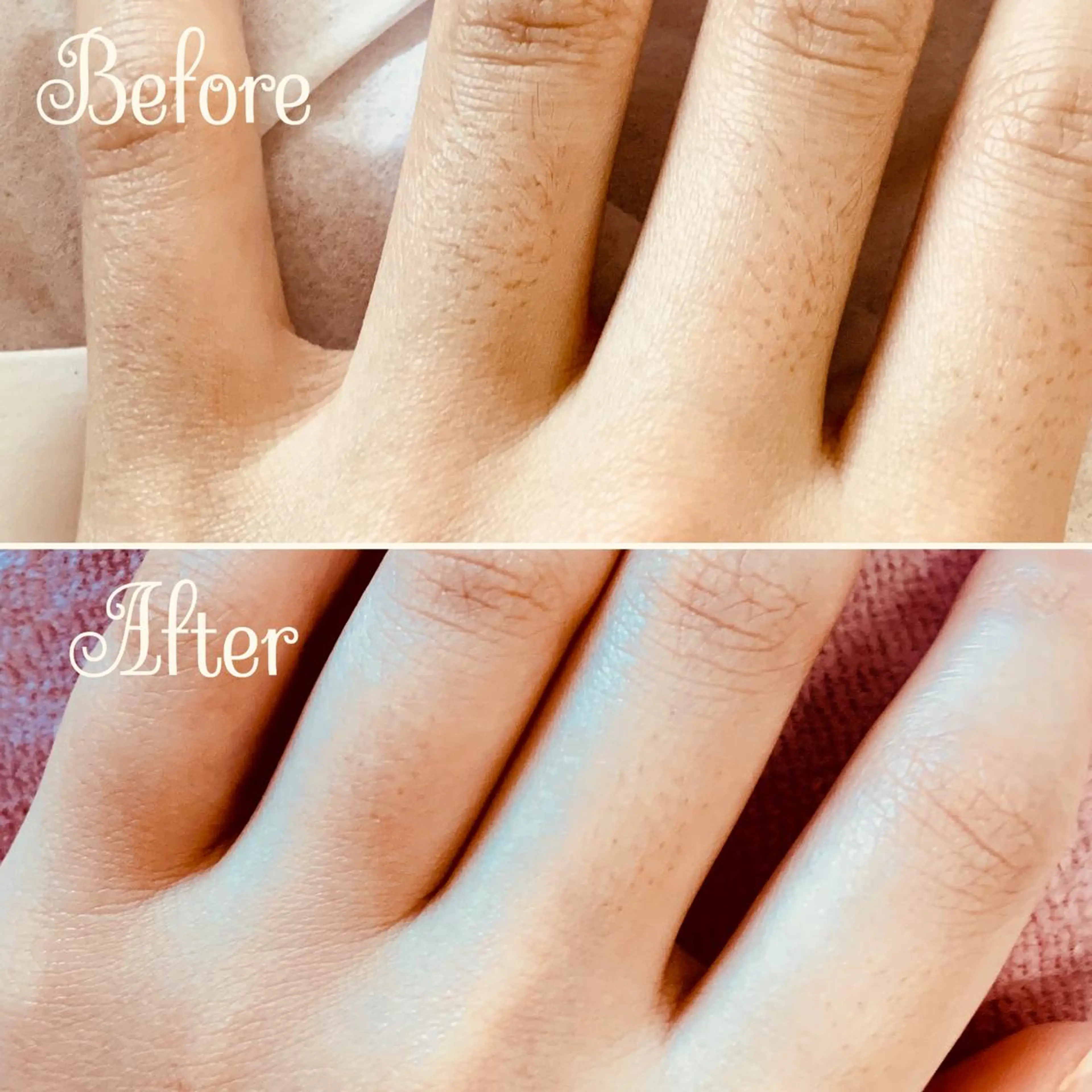 脱毛 Linomalie エステ/たるみ/脱毛のエステ・リラクイメージ