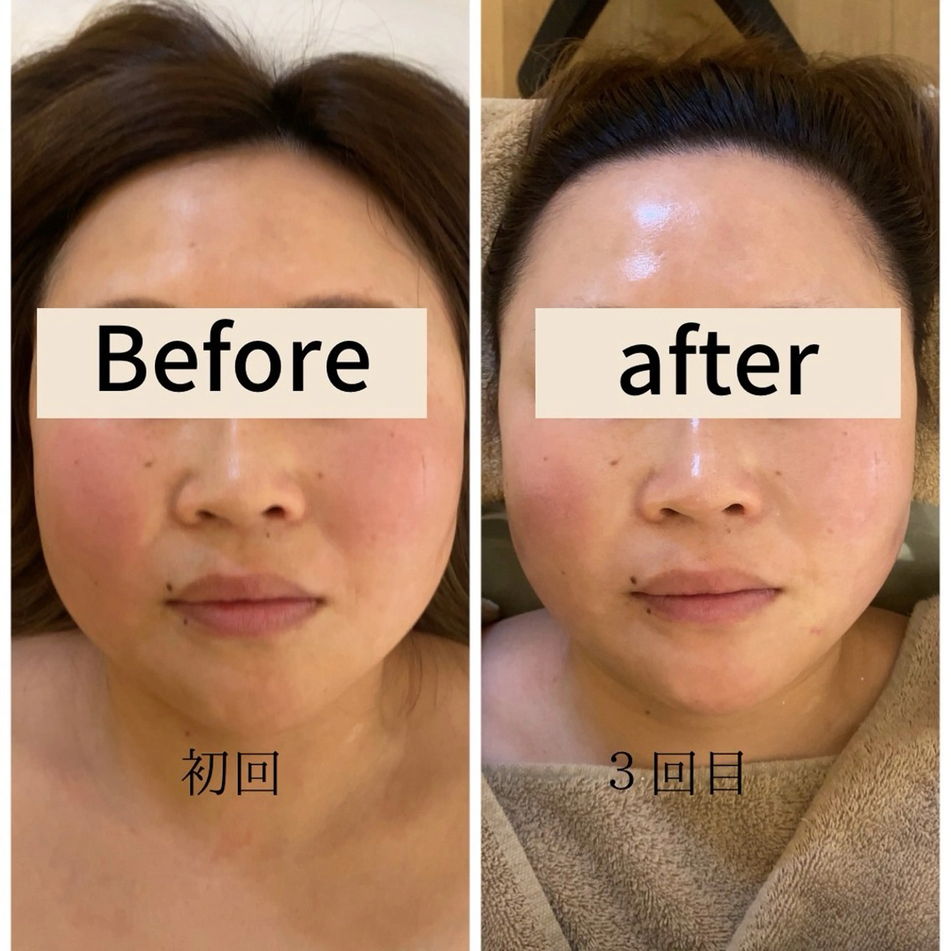 本格小顔コルギサロン ミピマムマールのエステ・リラクイメージ