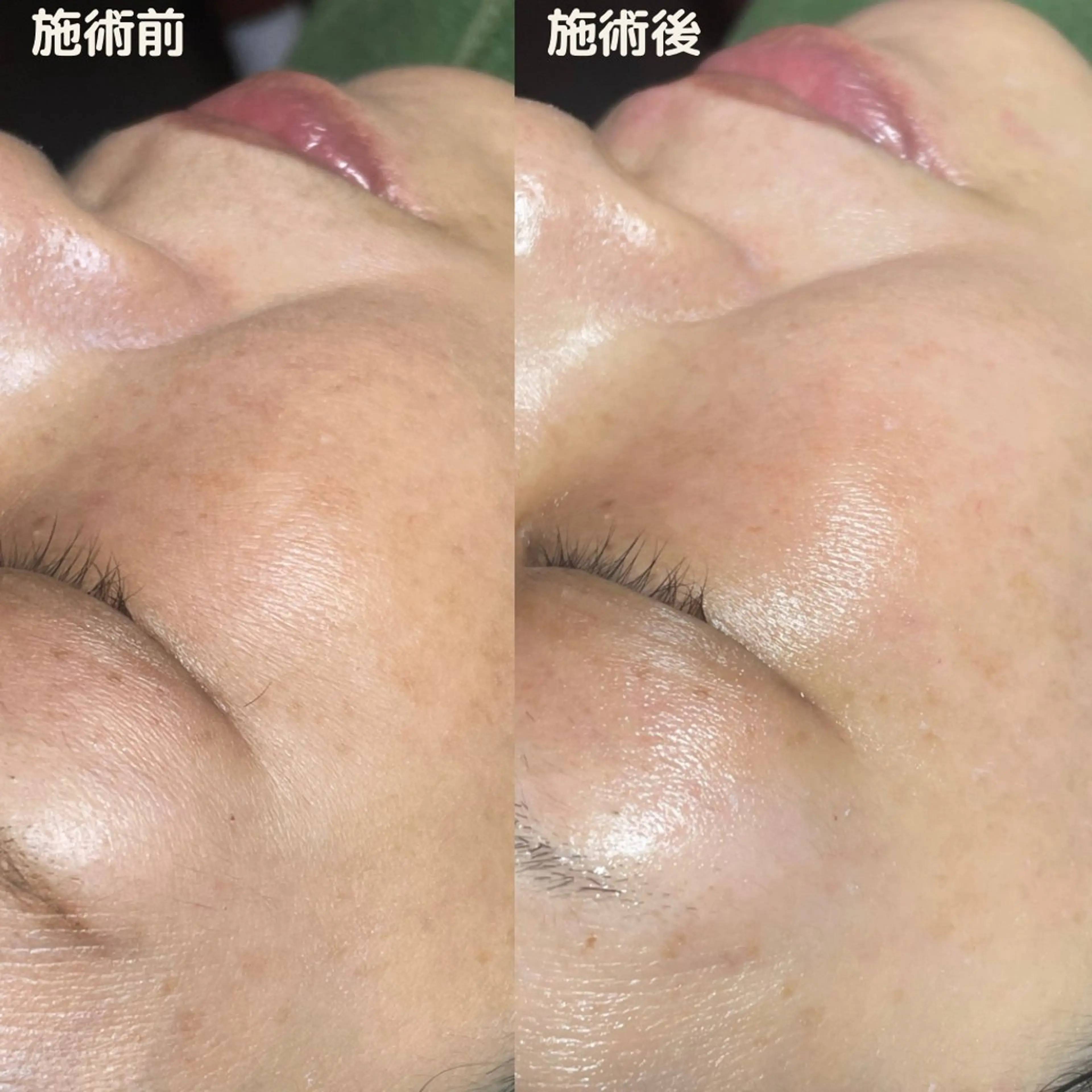 エステ リラク if byOrab riller【ｲﾌ】のその他イメージ