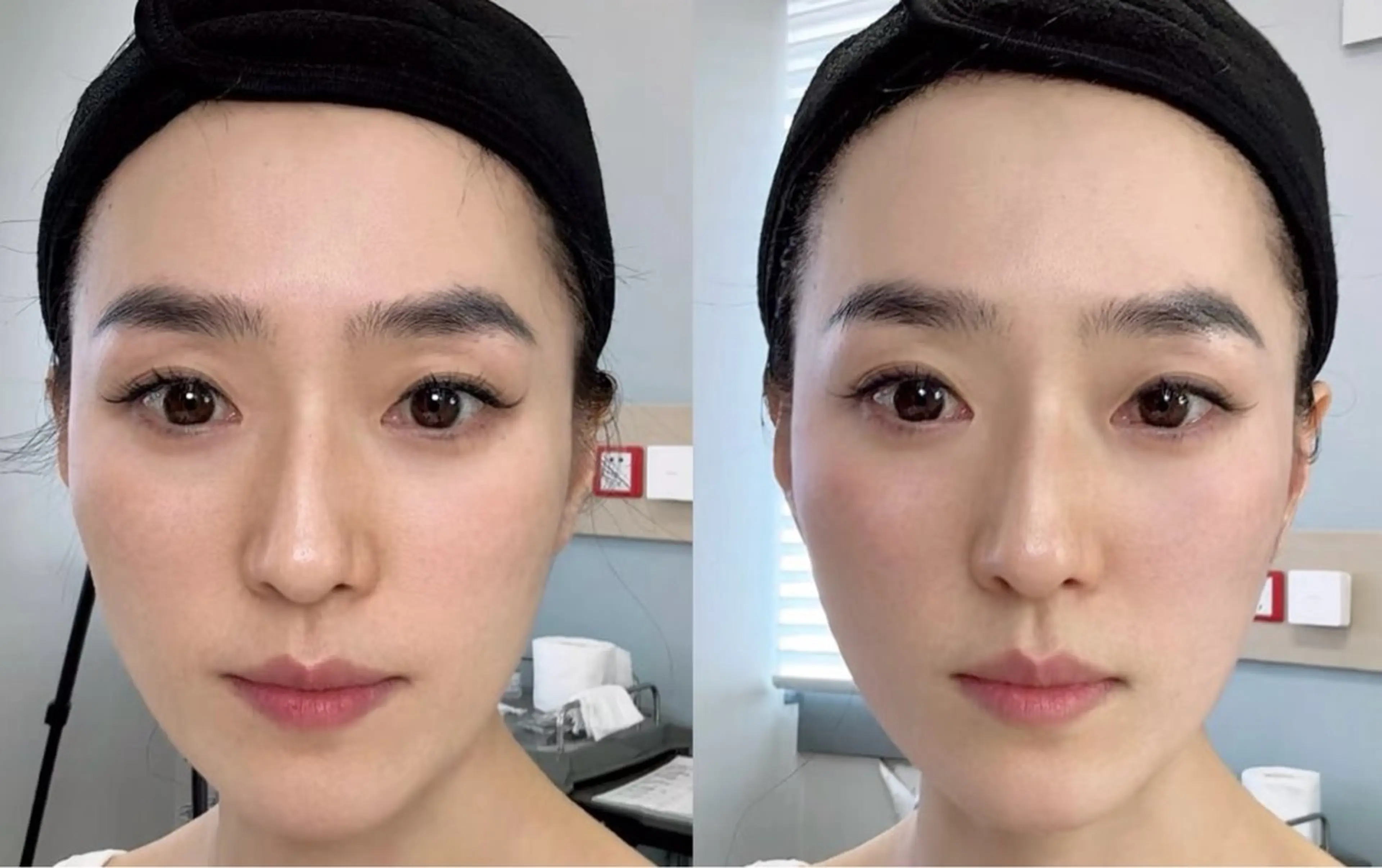 マツエク・マツパ エステ aliaハーブ水光店 エステティシャン募集のエステ・リラクイメージ