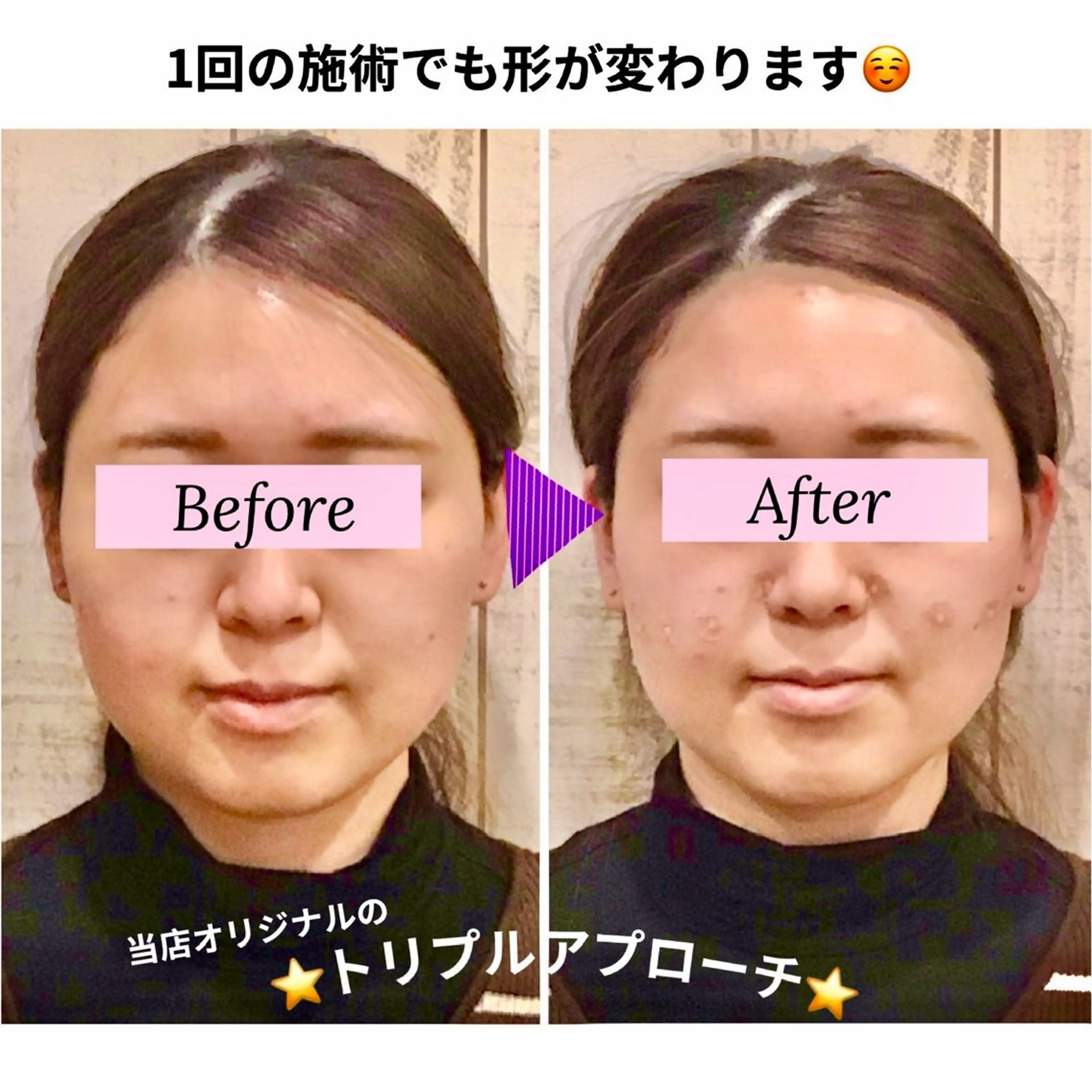 エステ リラク 小顔矯正Speed KOGAO渋谷本店のエステ・リラクイメージ