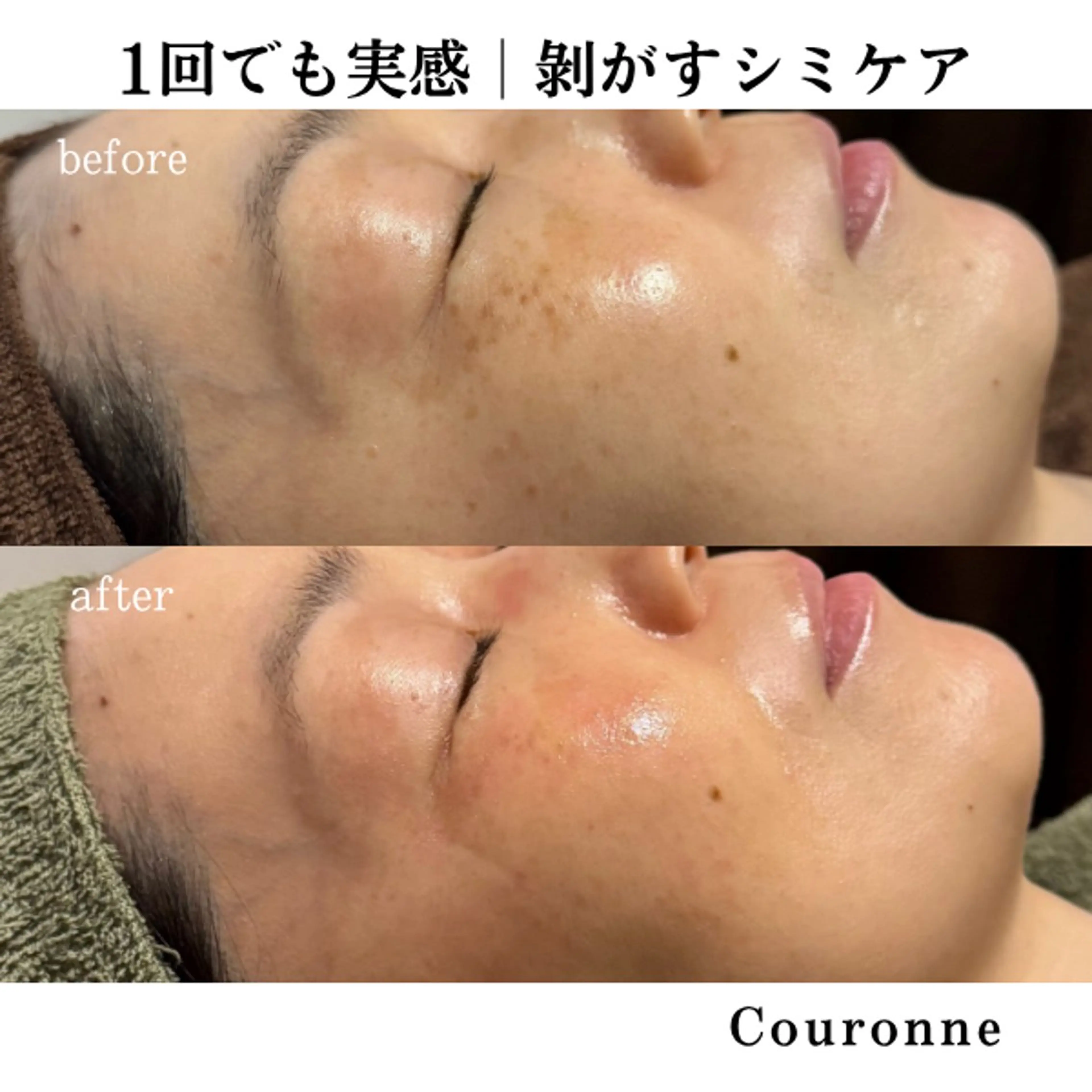 エステ シミ・毛穴ケア専門 クロヌYUKIのエステ・リラクイメージ