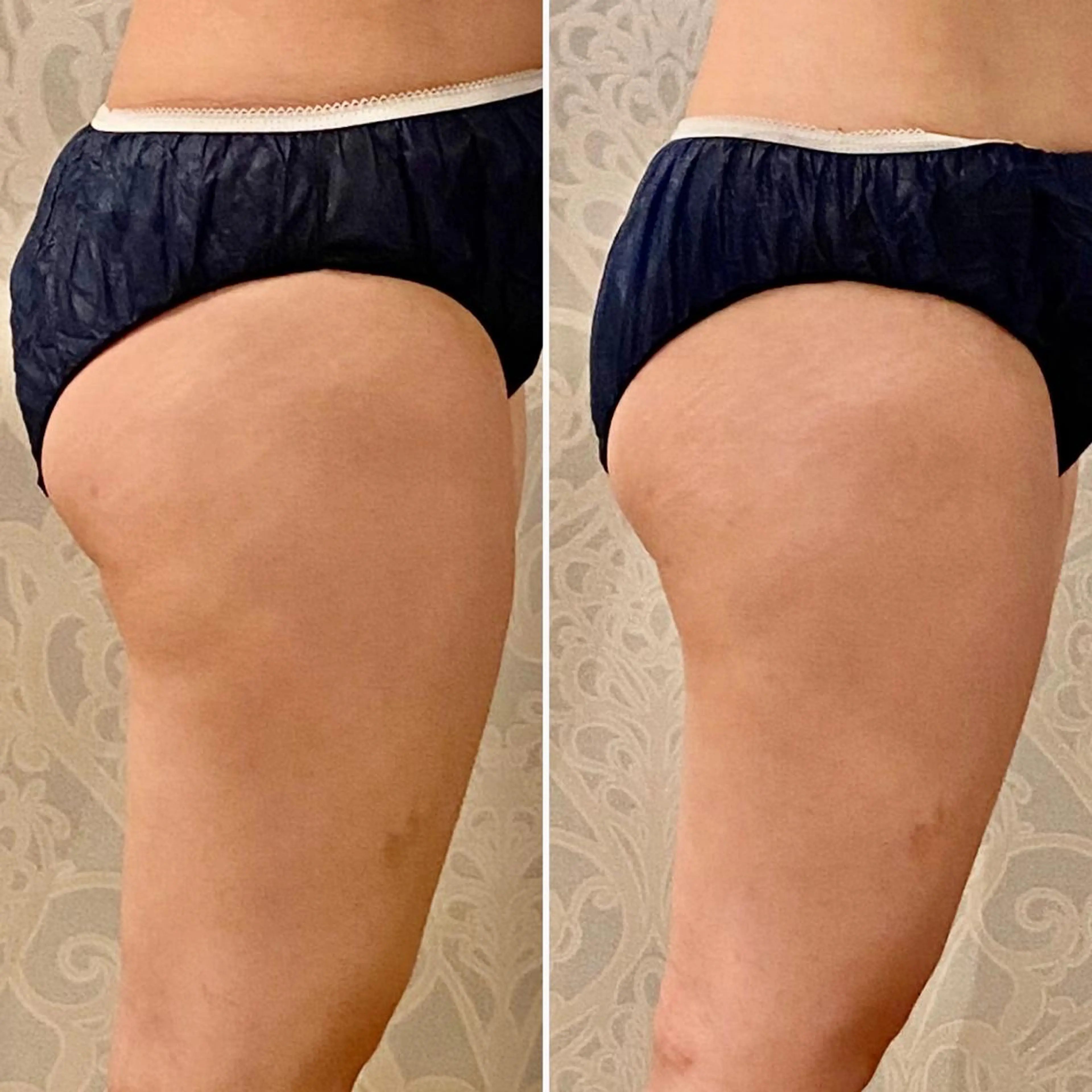 🥀エステティック レイビス横浜　永🥀のエステ・リラクイメージ