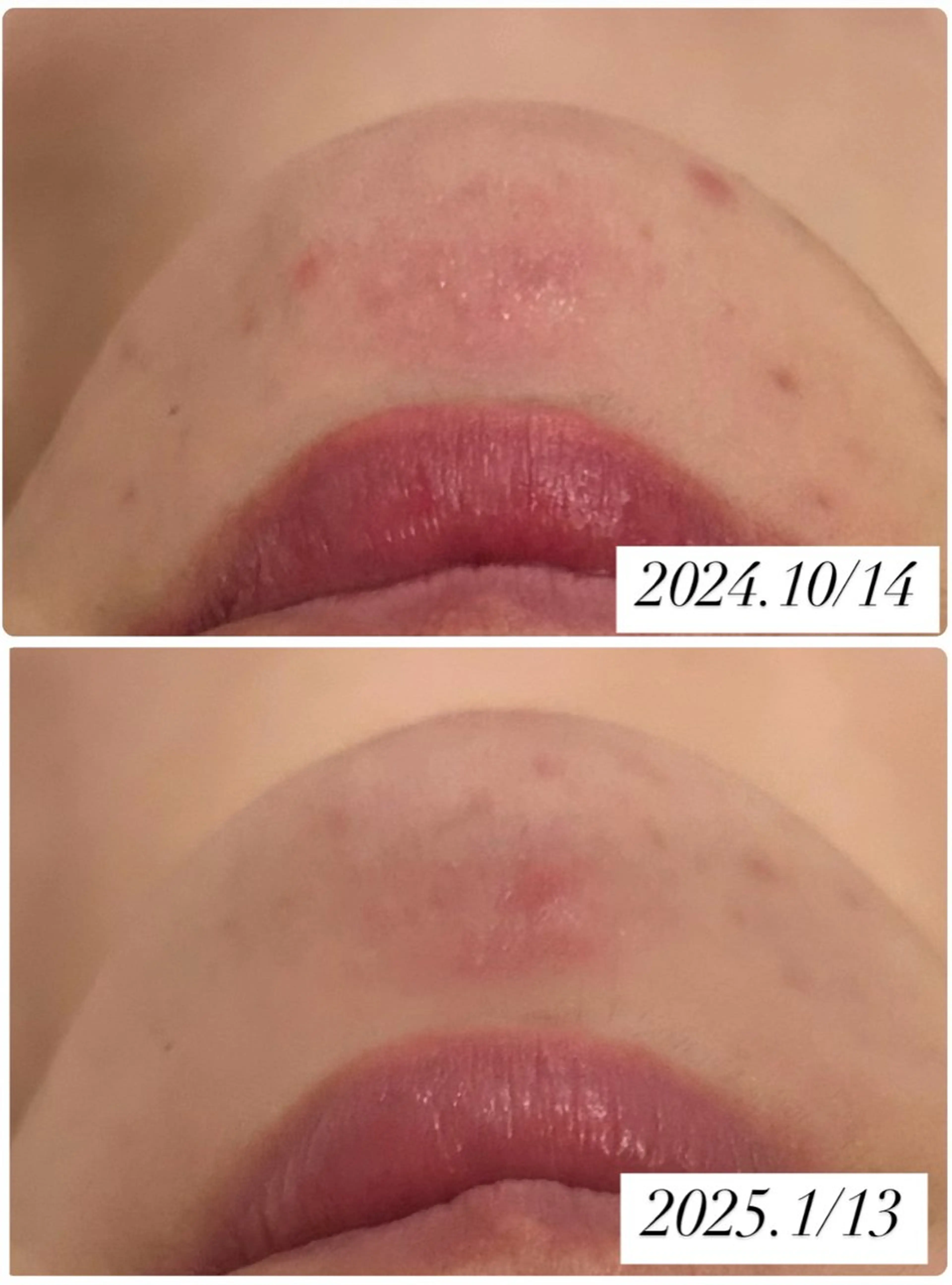 エステ リラク メナード片町 やまもと みくのエステ・リラクイメージ