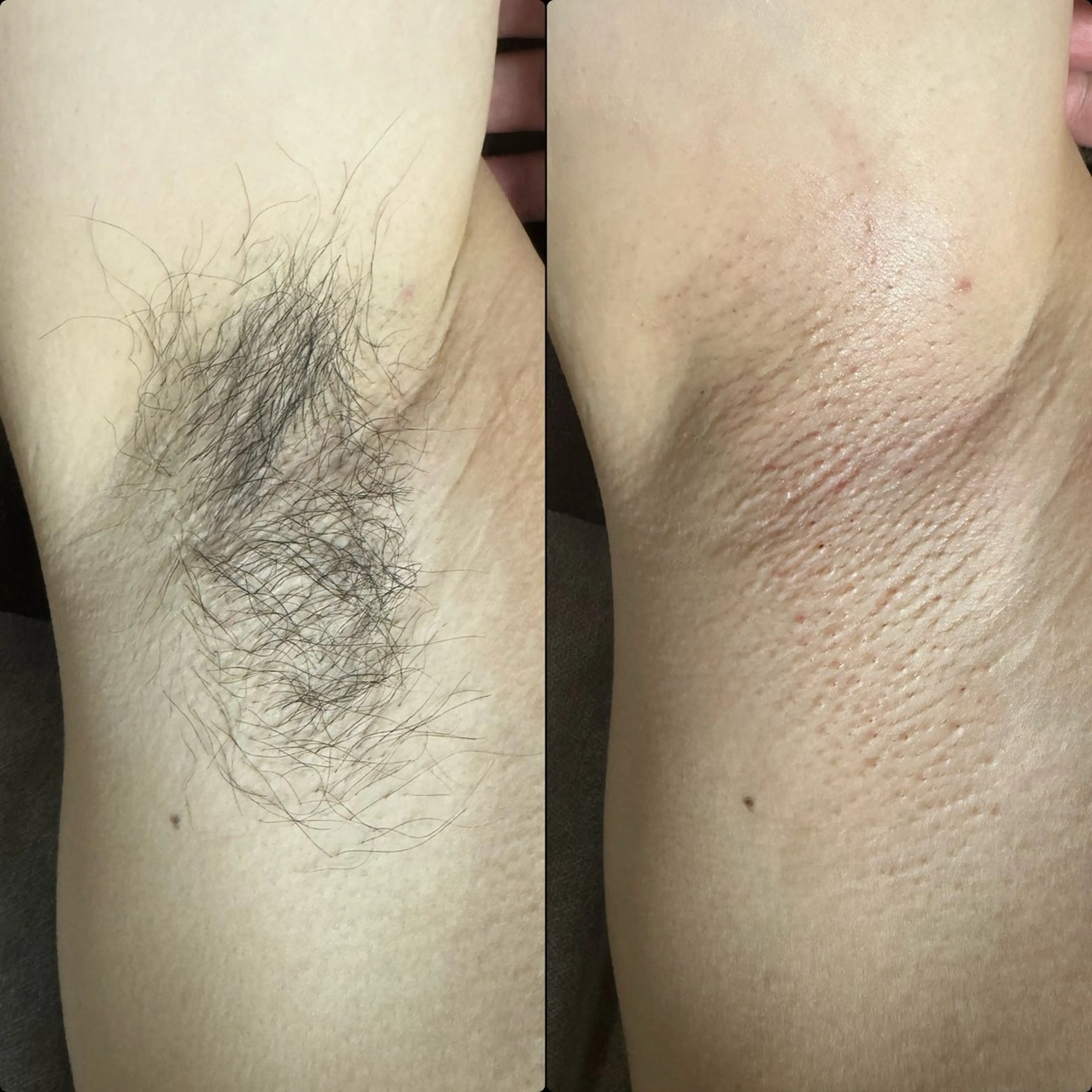 メンズ 六本木脱毛andS 店長Sachiのエステ・リラクイメージ