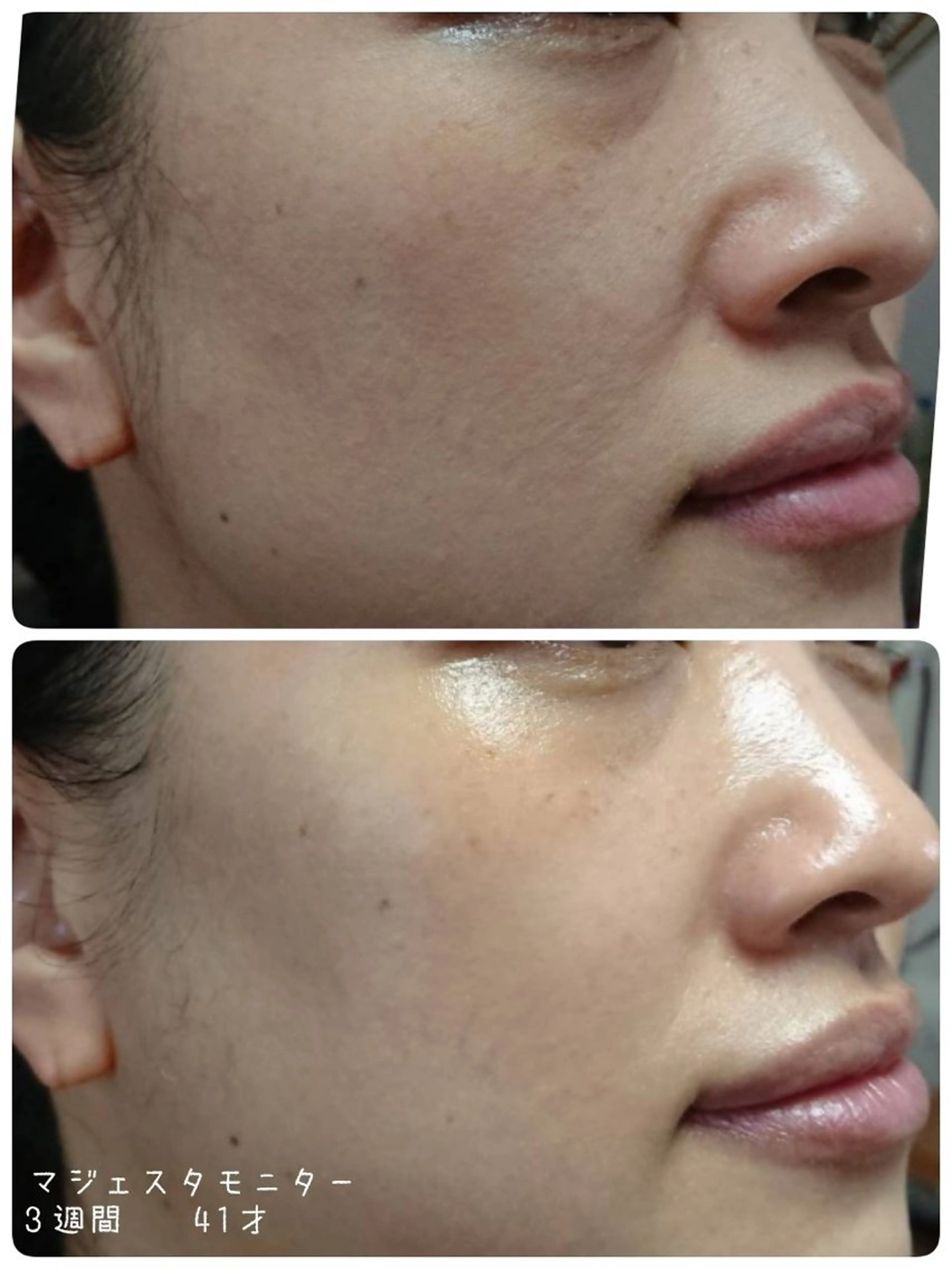 エステ nozomi.m🌷 narisのエステ・リラクイメージ