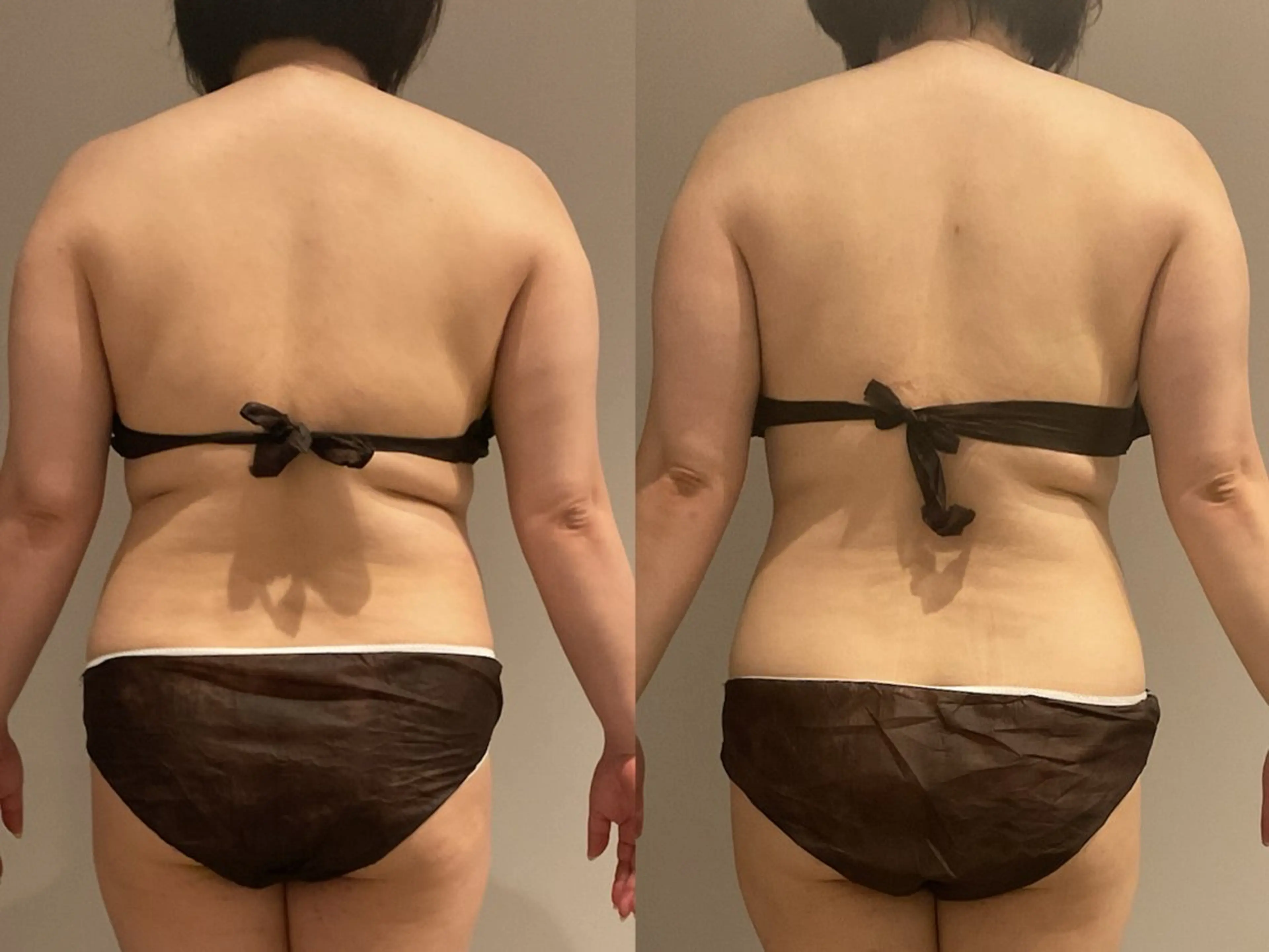 Esthetic MiEUXのエステ・リラクイメージ