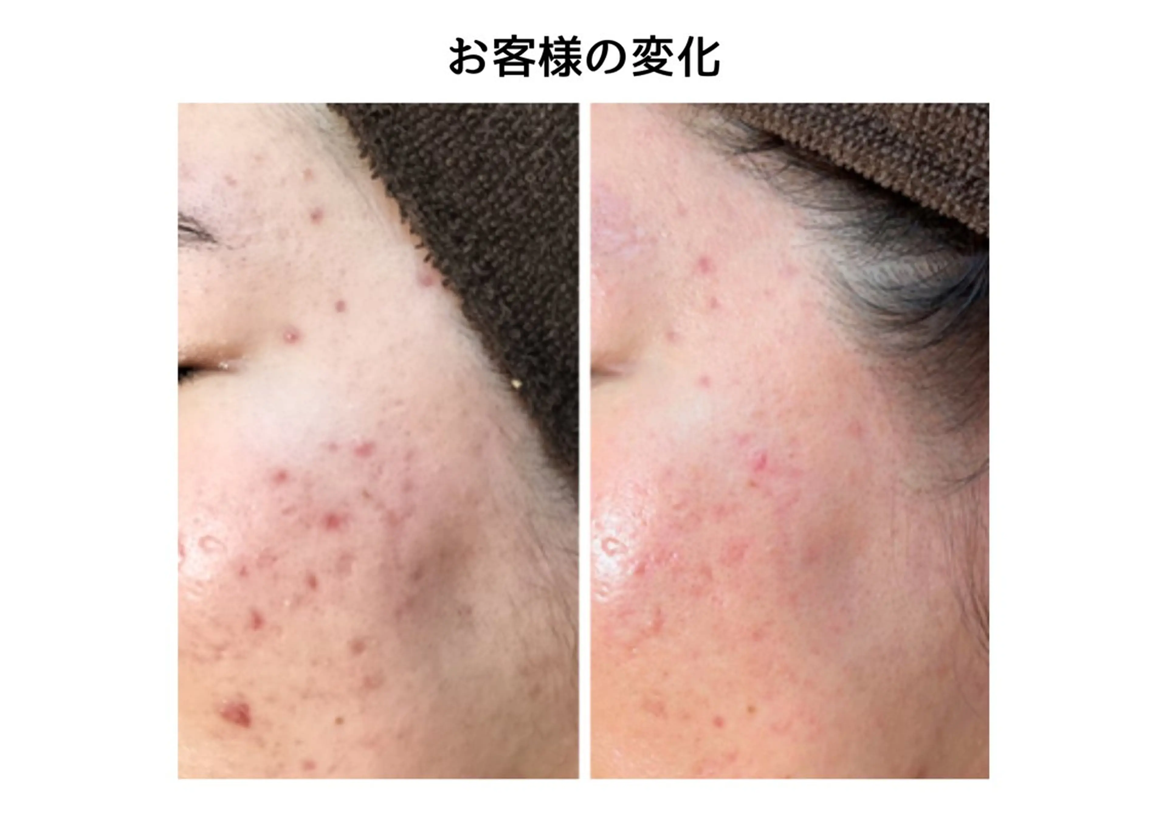 近藤 みさきのエステ・リラクイメージ