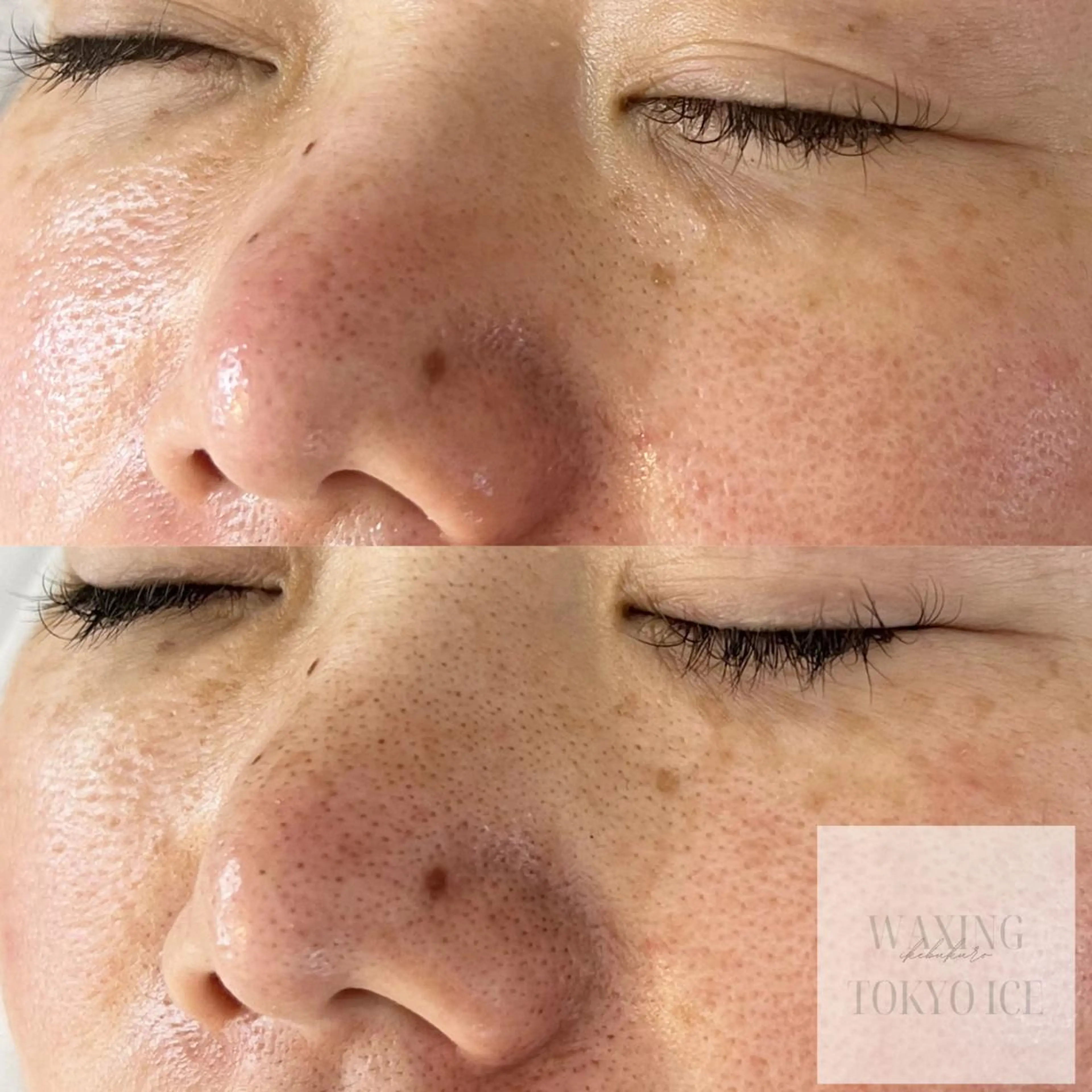 セミロング ヘアアレンジ アイブロウ エステ ワックス脱毛専門店 ICE 池袋の眉毛・アイブロウイメージ