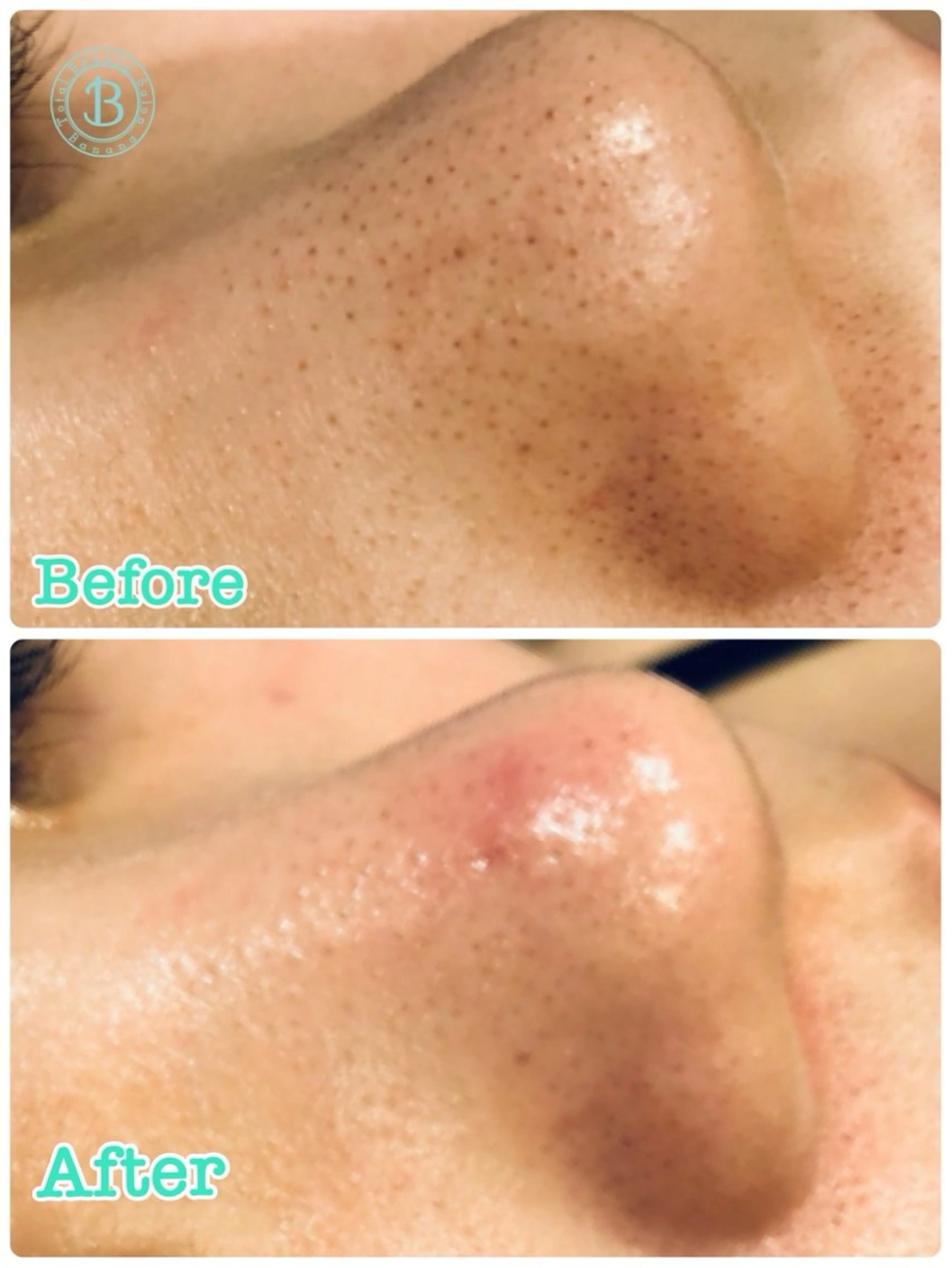 エステ 加藤 葵のエステ・リラクイメージ