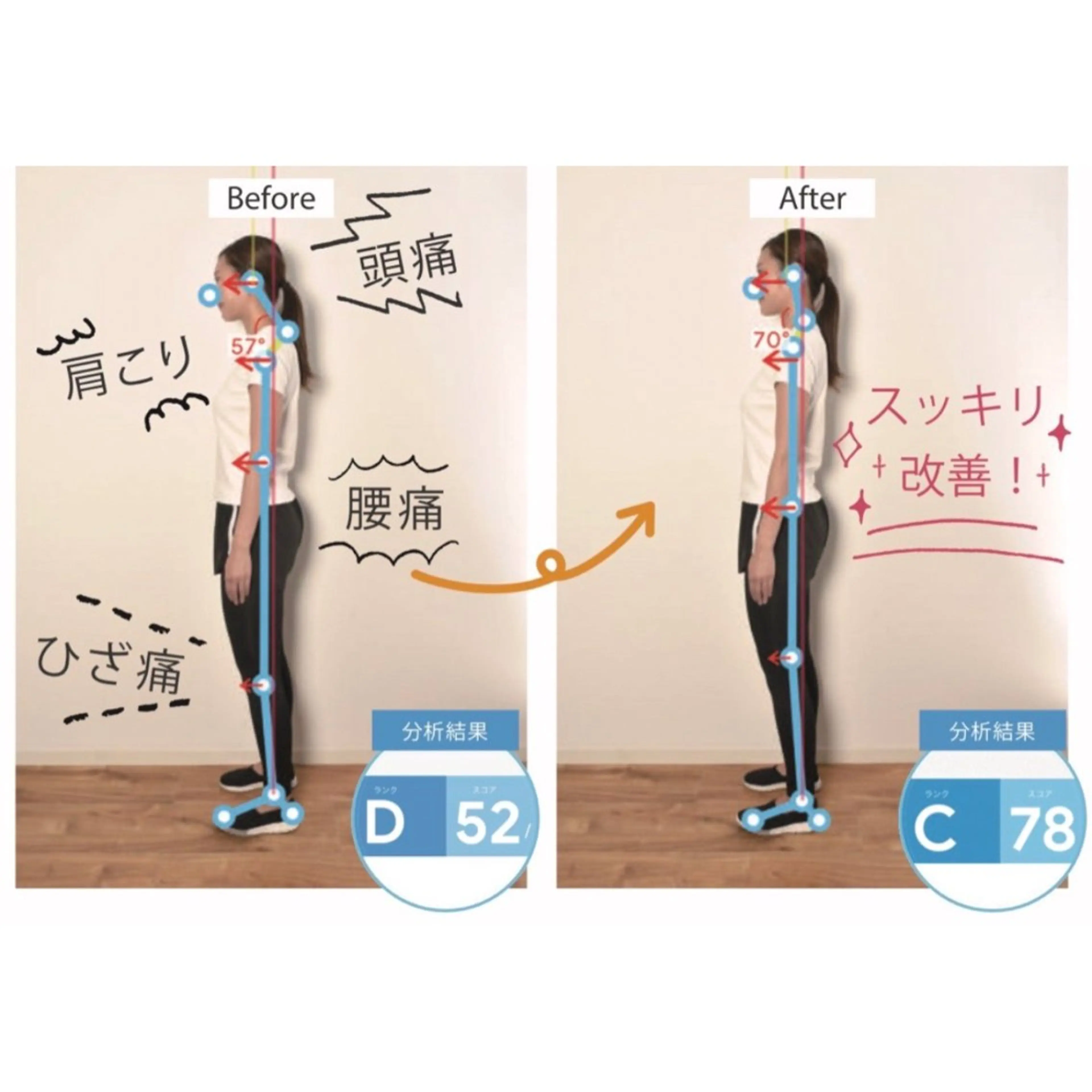 骨盤矯正・姿勢矯正 肩こり・腰痛整体のエステ・リラクイメージ