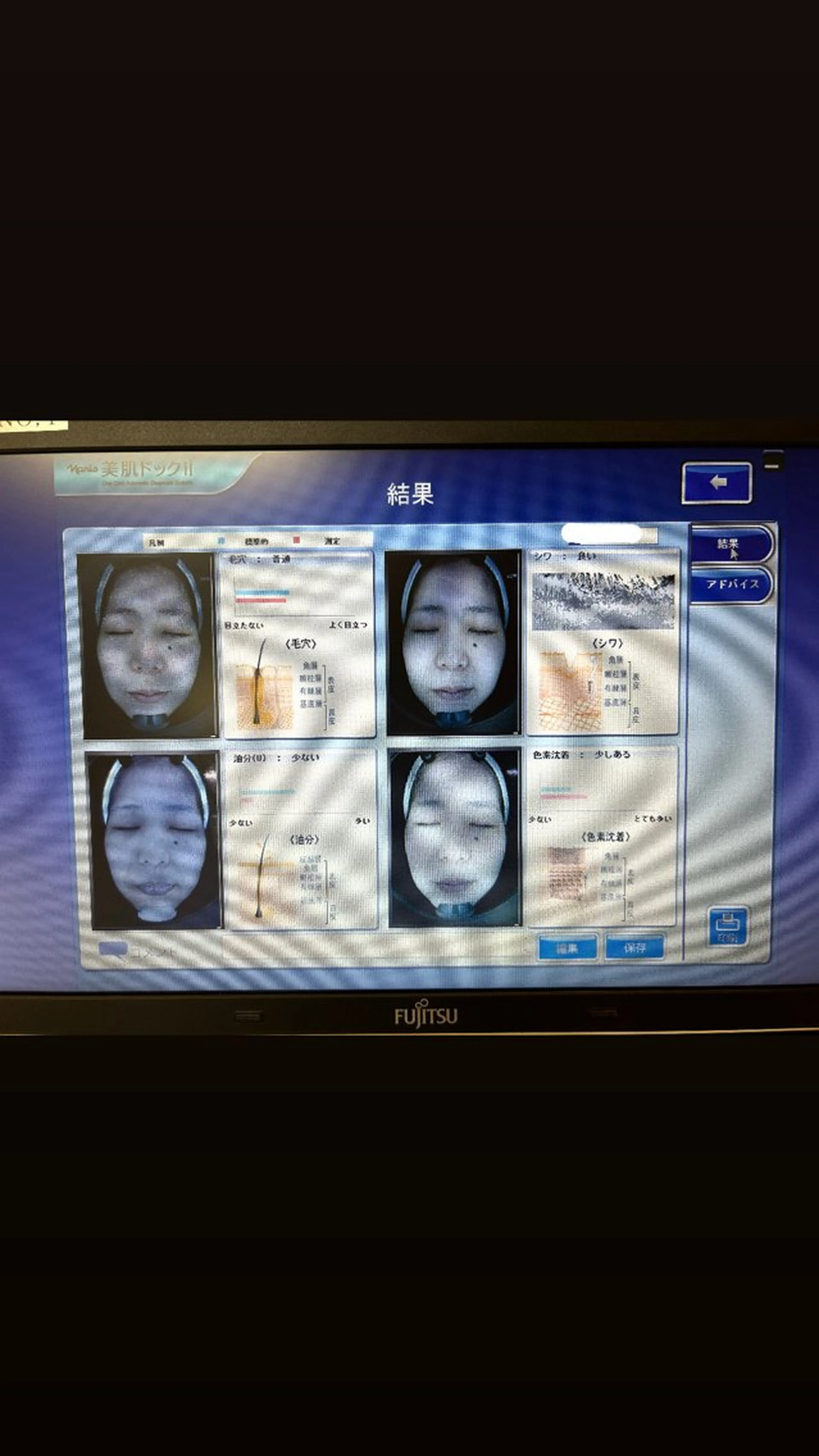 【先着3名様限定 特別価格】肌年齢や将来のシミ、毛穴の個数までわかる本格肌診断の写真