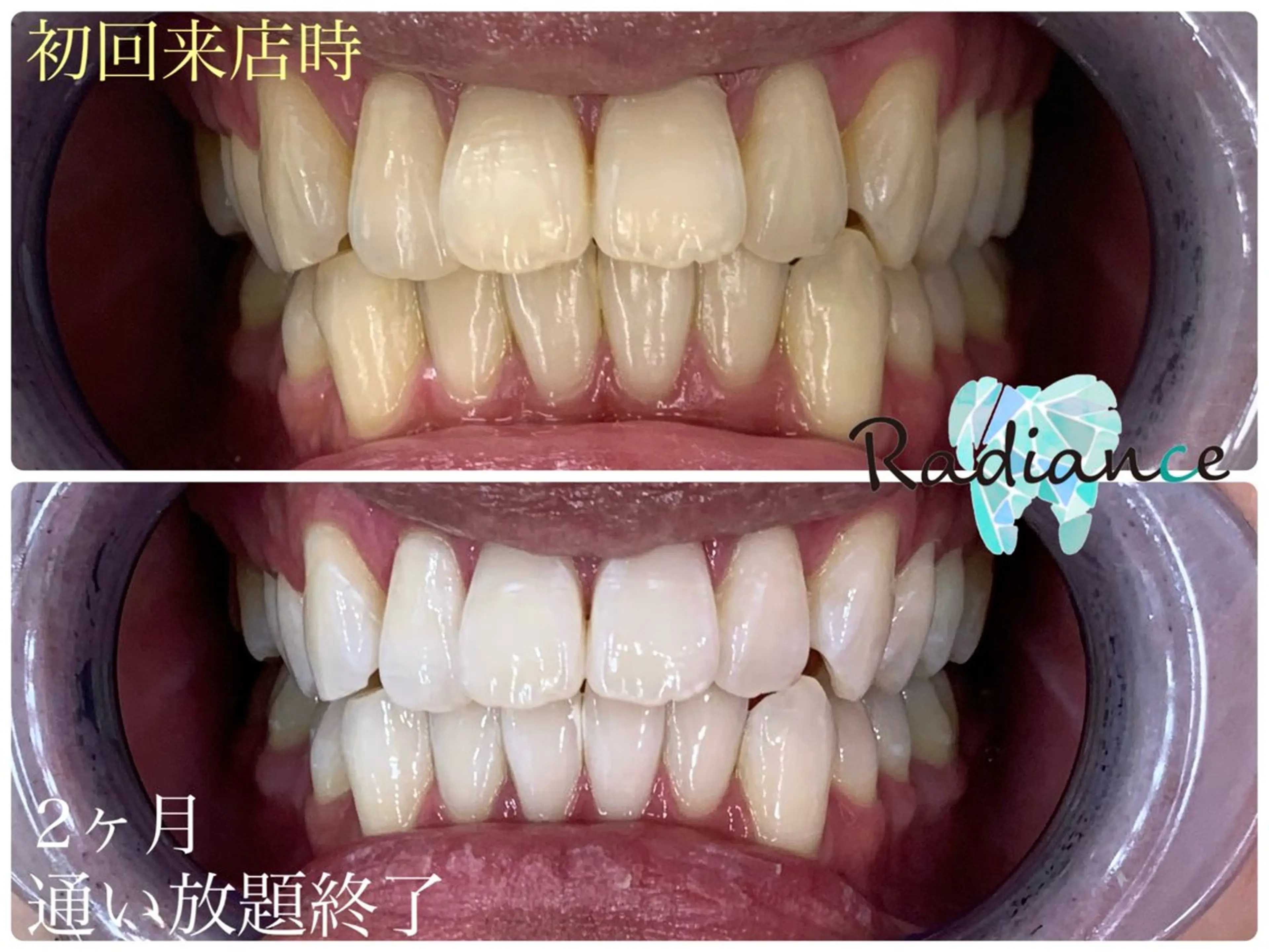 札幌ホワイトニング ラディアンス札幌駅店のその他イメージ