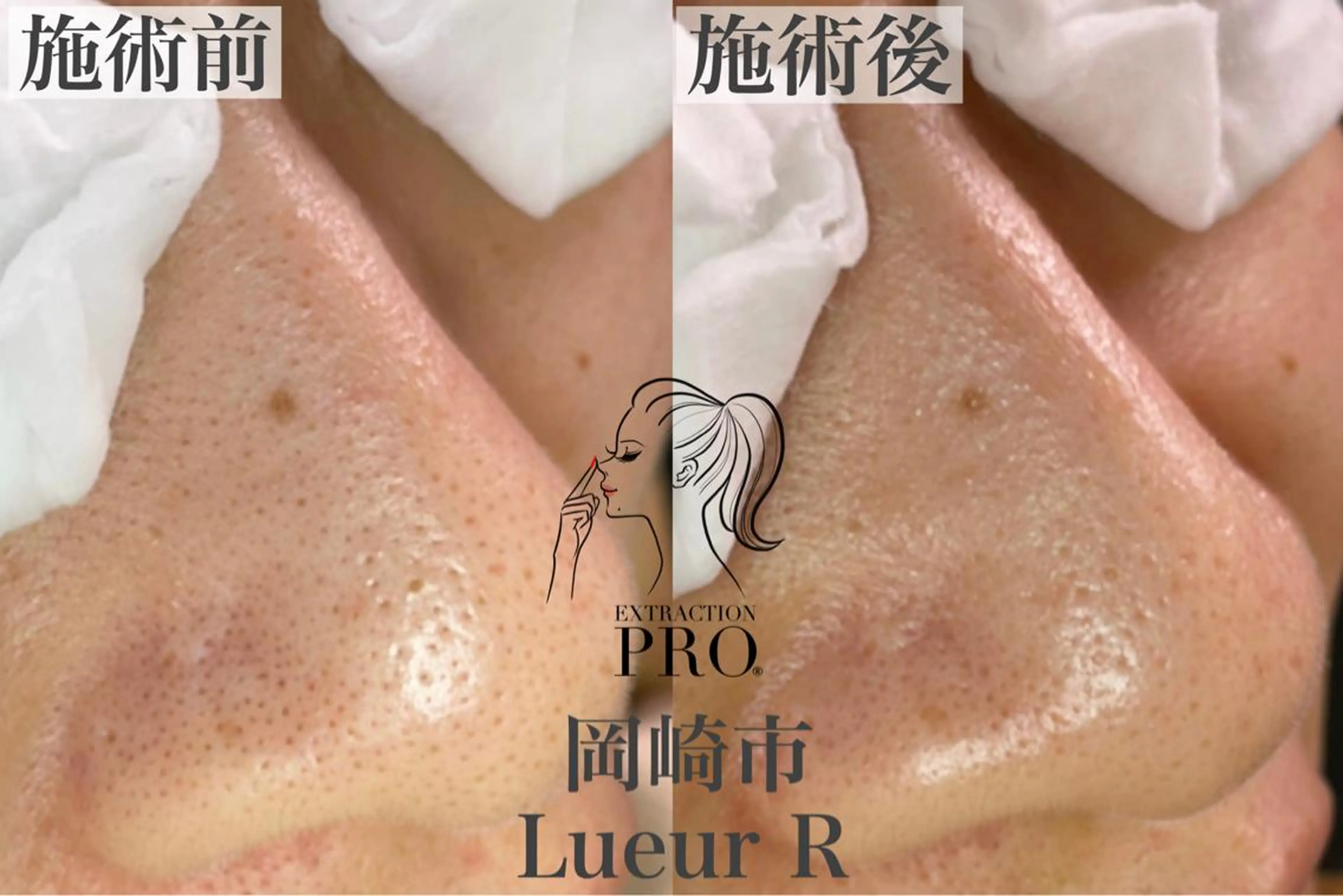 エステ 大久保 里奈のエステ・リラクイメージ