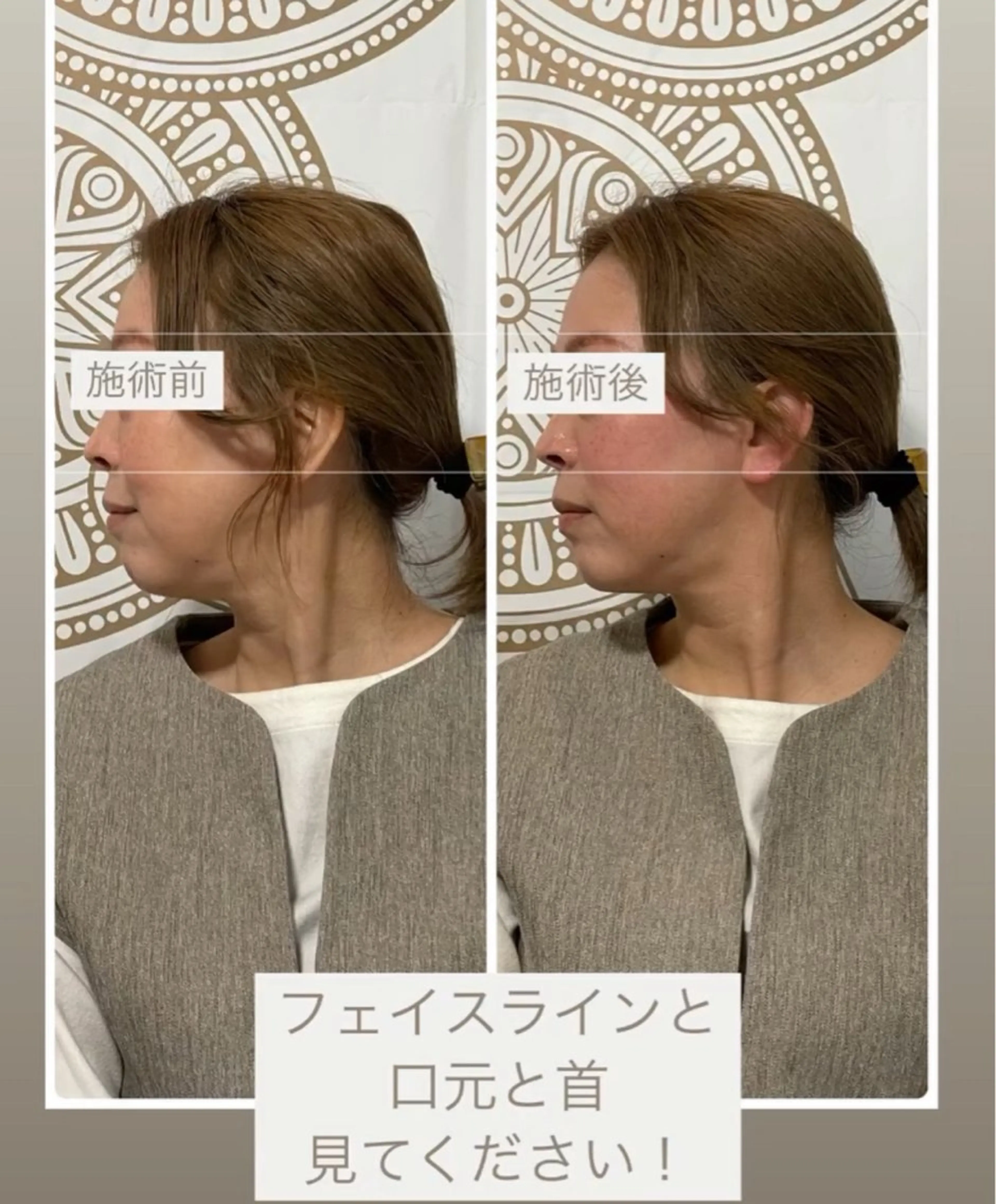 感動のリフトアップ◎耳と頭アロマ耳つぼ美容整体の写真