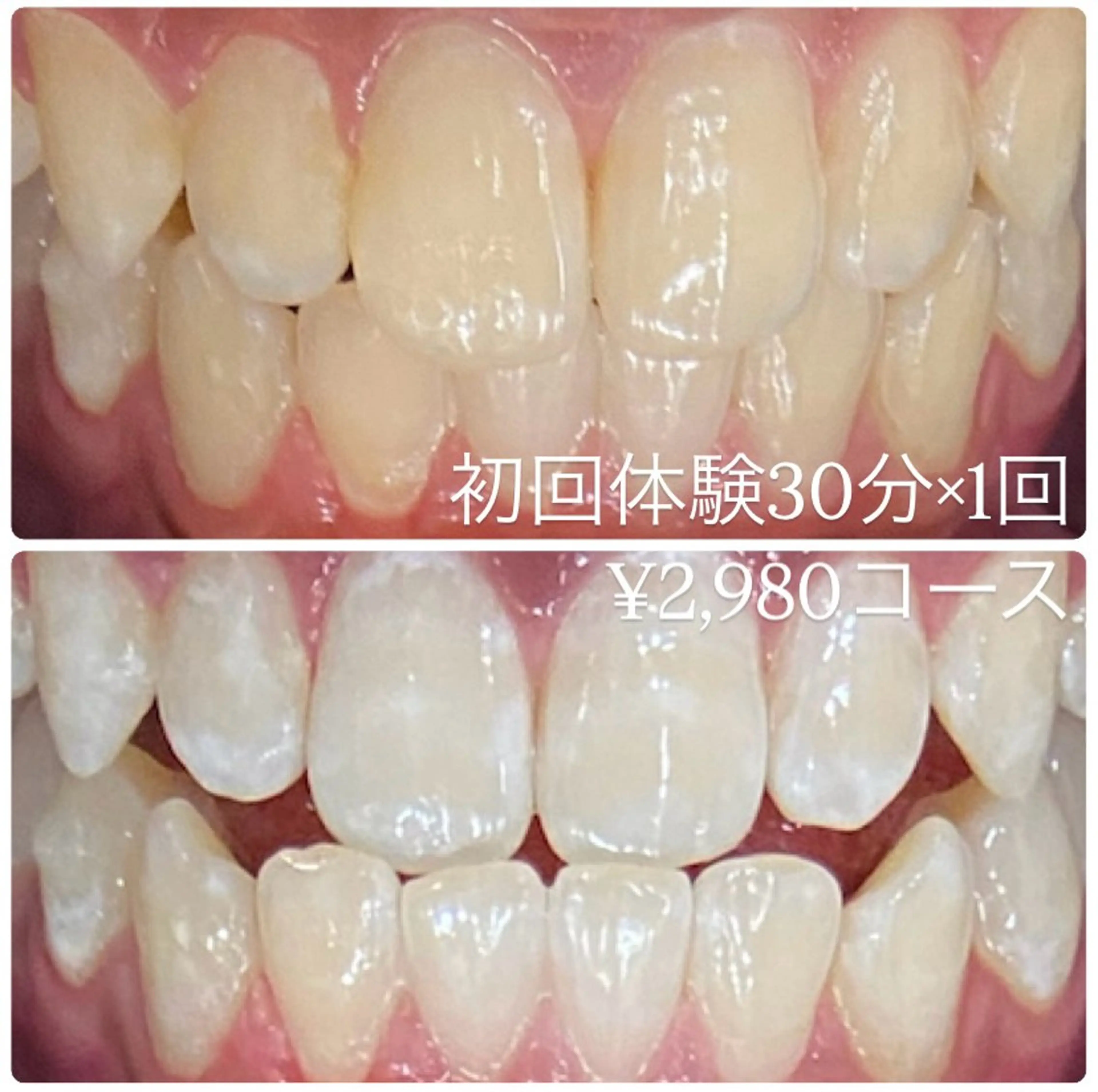 ホワイトニングルーム 横浜店のその他イメージ