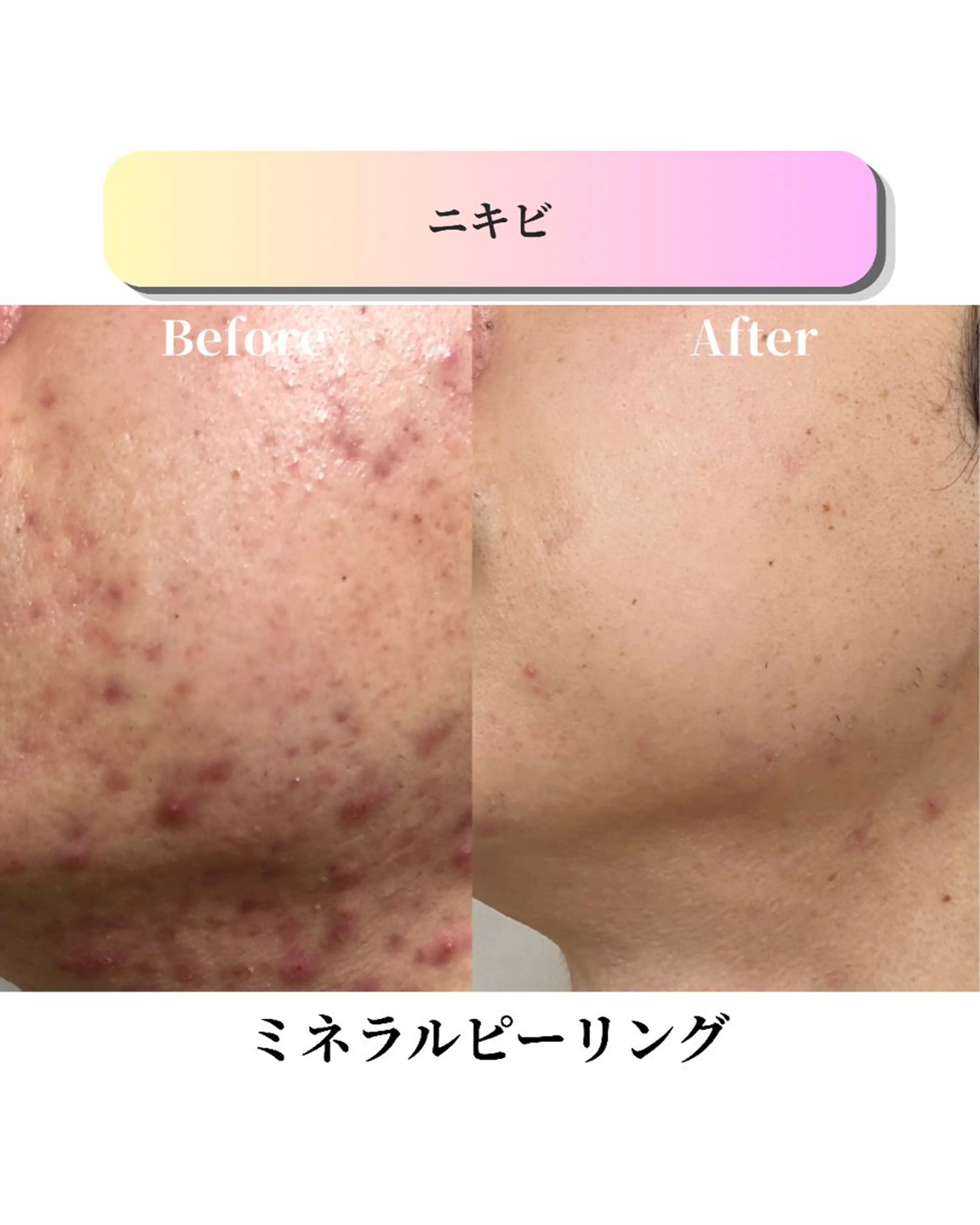 エステ ローズフィールド 森岡朋美のエステ・リラクイメージ