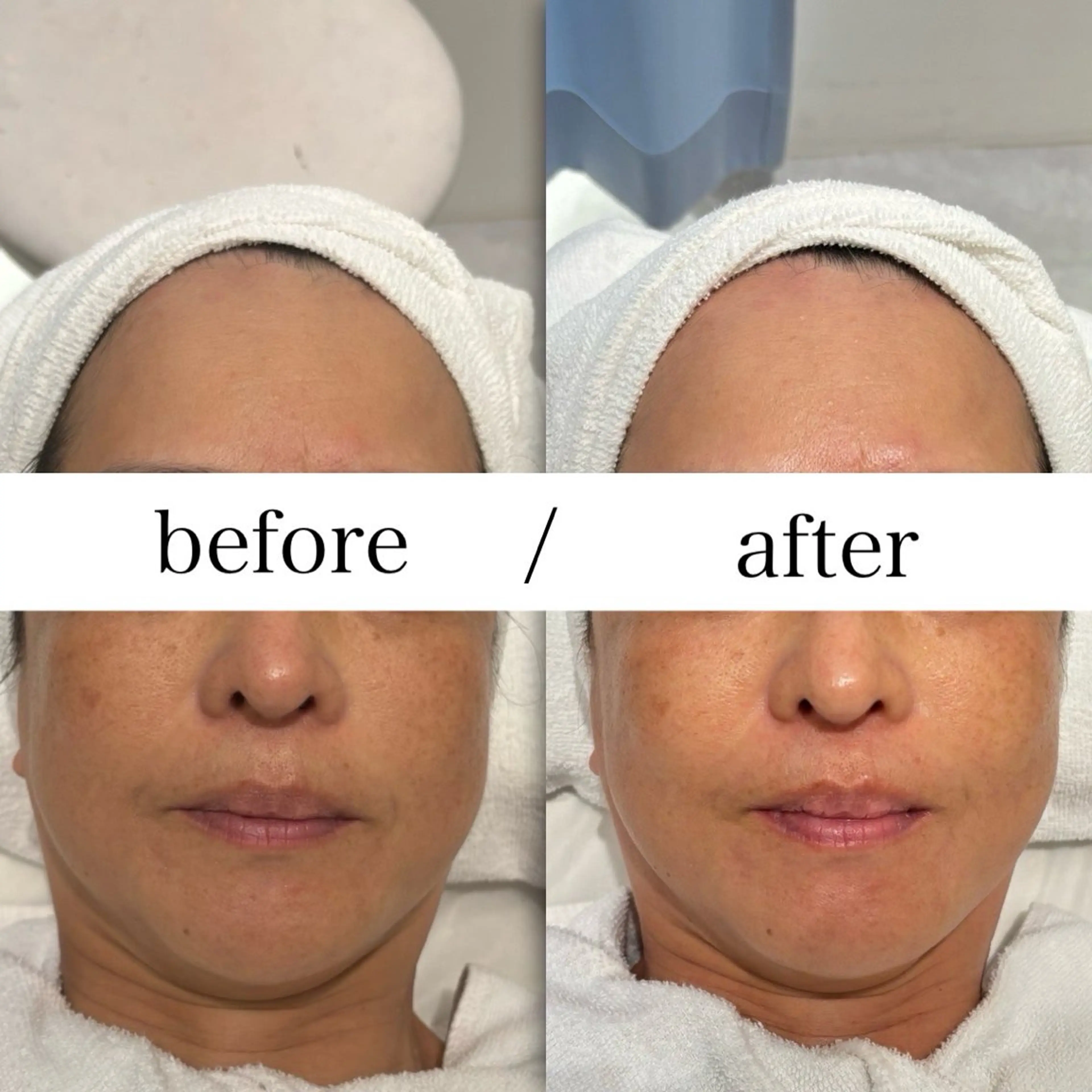 FOXYLASH inoueのエステ・リラクイメージ