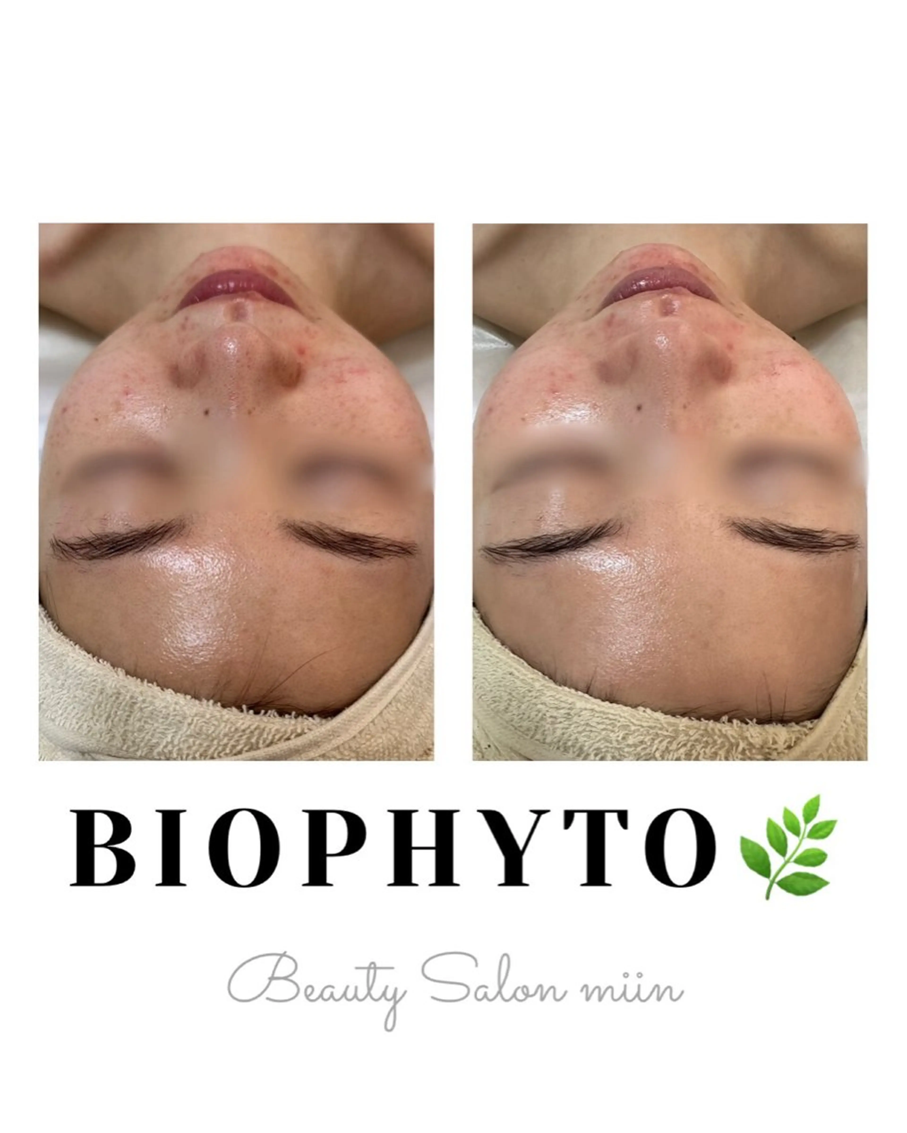 エステ 韓国肌管理 白玉肌管理®︎のエステ・リラクイメージ