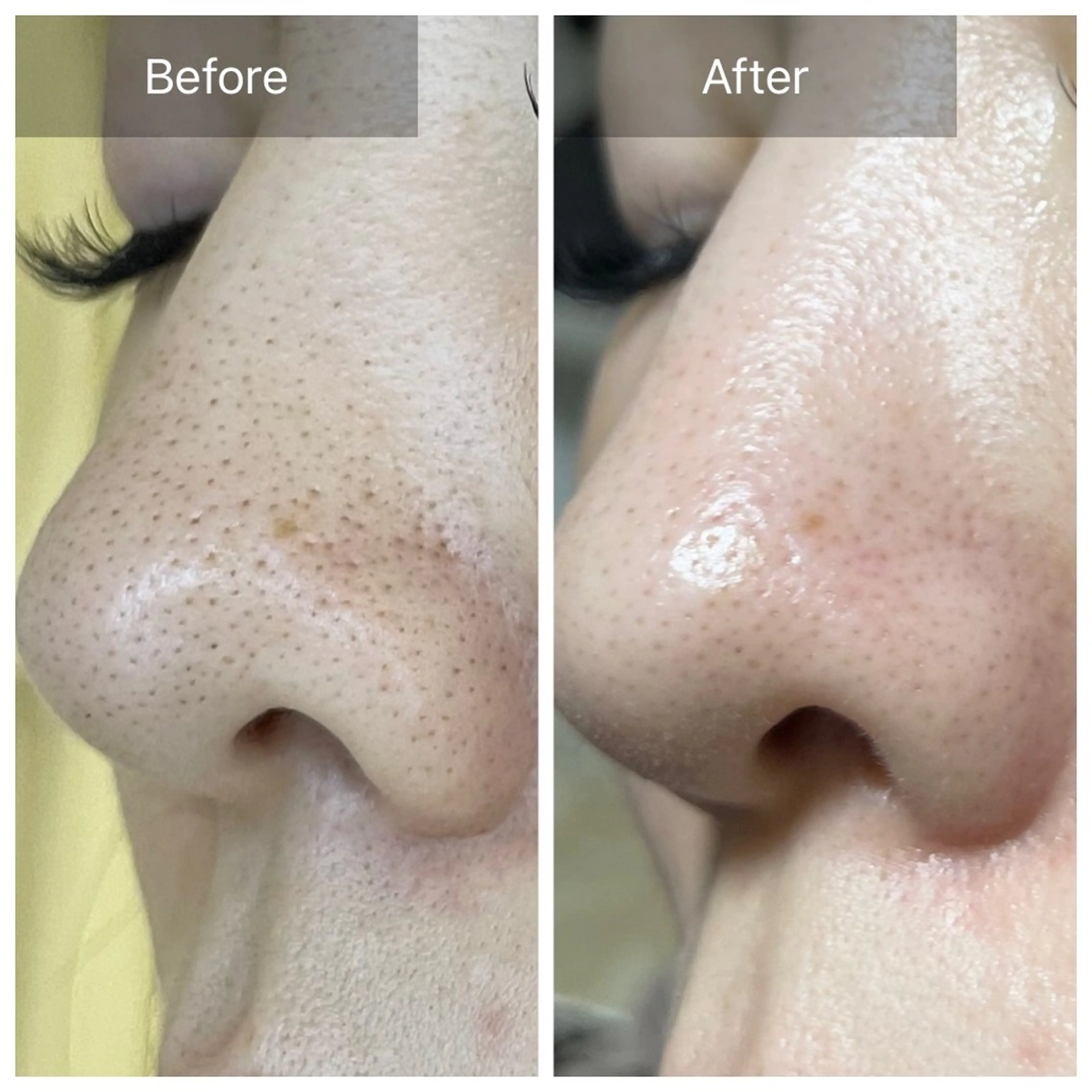 バフトアップ/ハーブ Nornのエステ・リラクイメージ