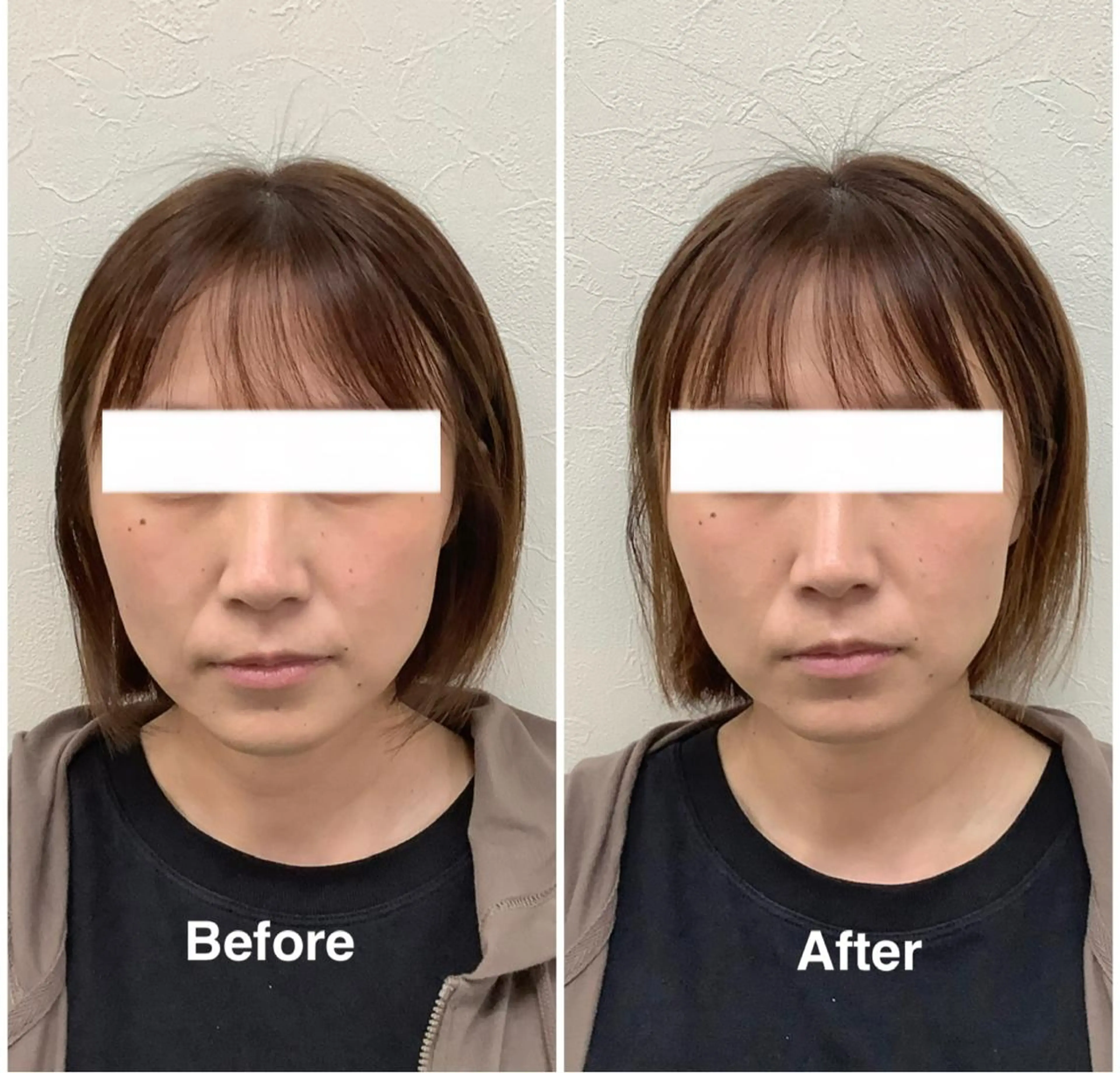 エステ リラク だいち 鍼灸院　伊伝居院のエステ・リラクイメージ