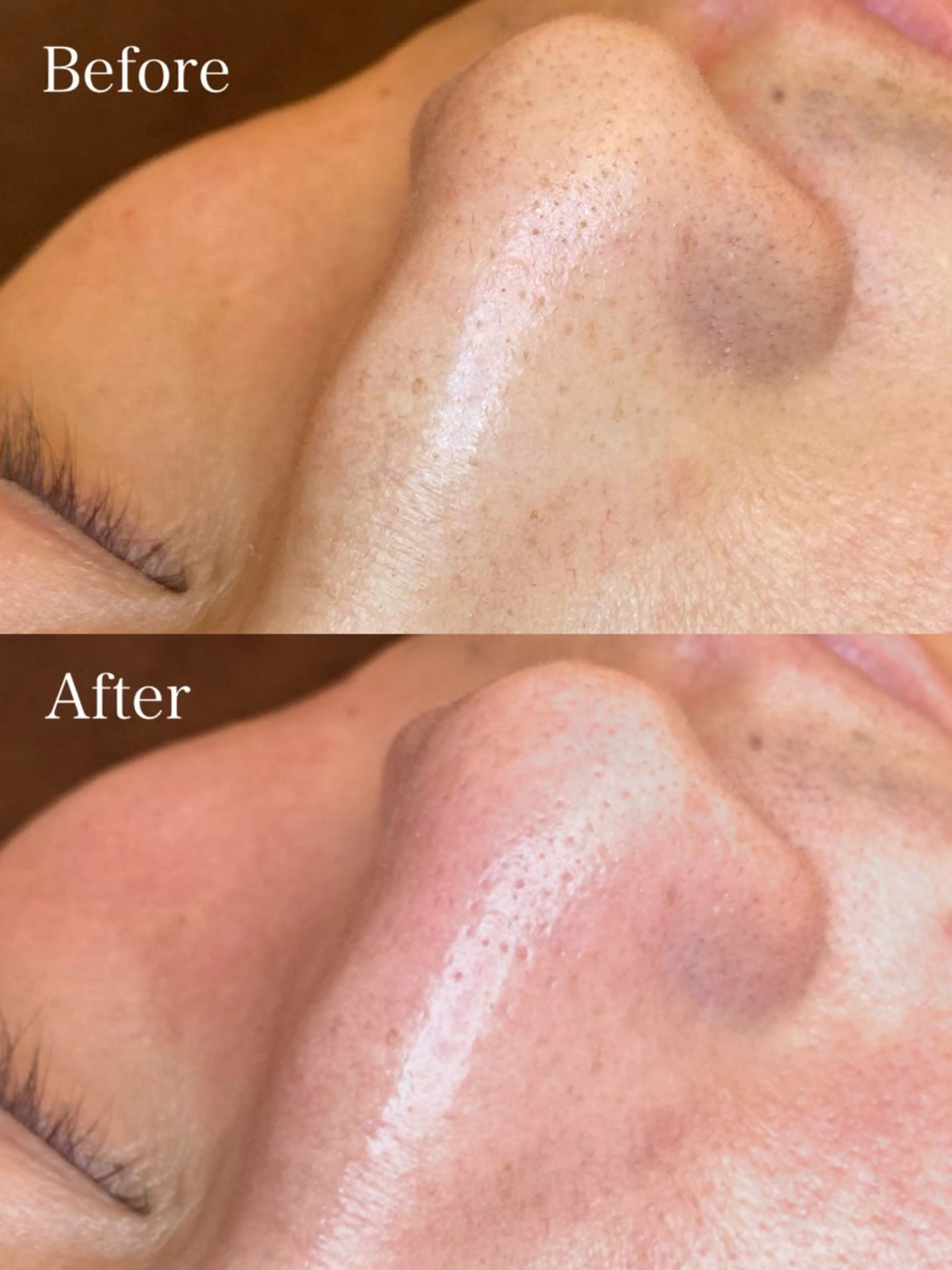 🤍アベシュリ /フェイシャル🤍のエステ・リラクイメージ