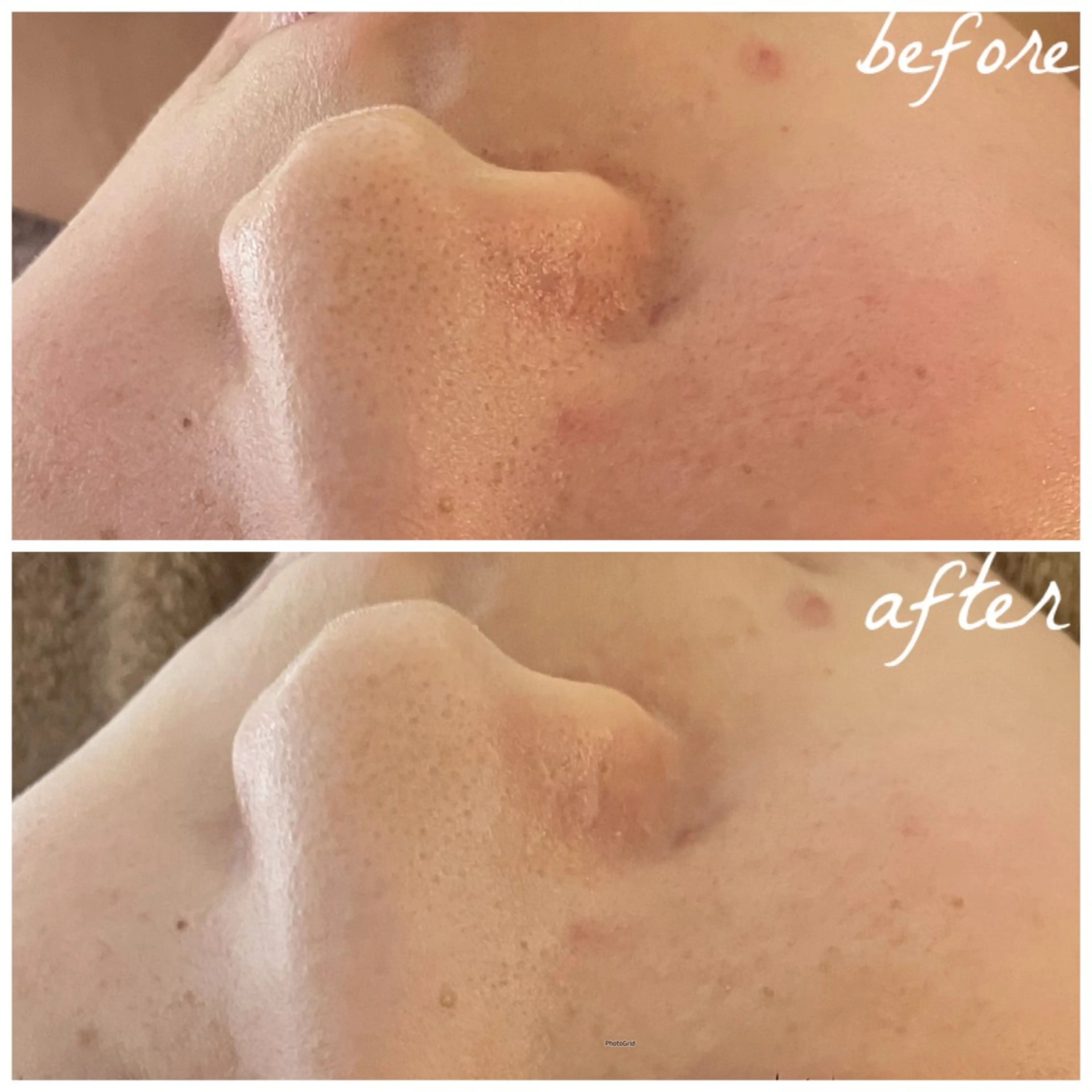 メンズ メナード岐阜茜部 杉浦のエステ・リラクイメージ