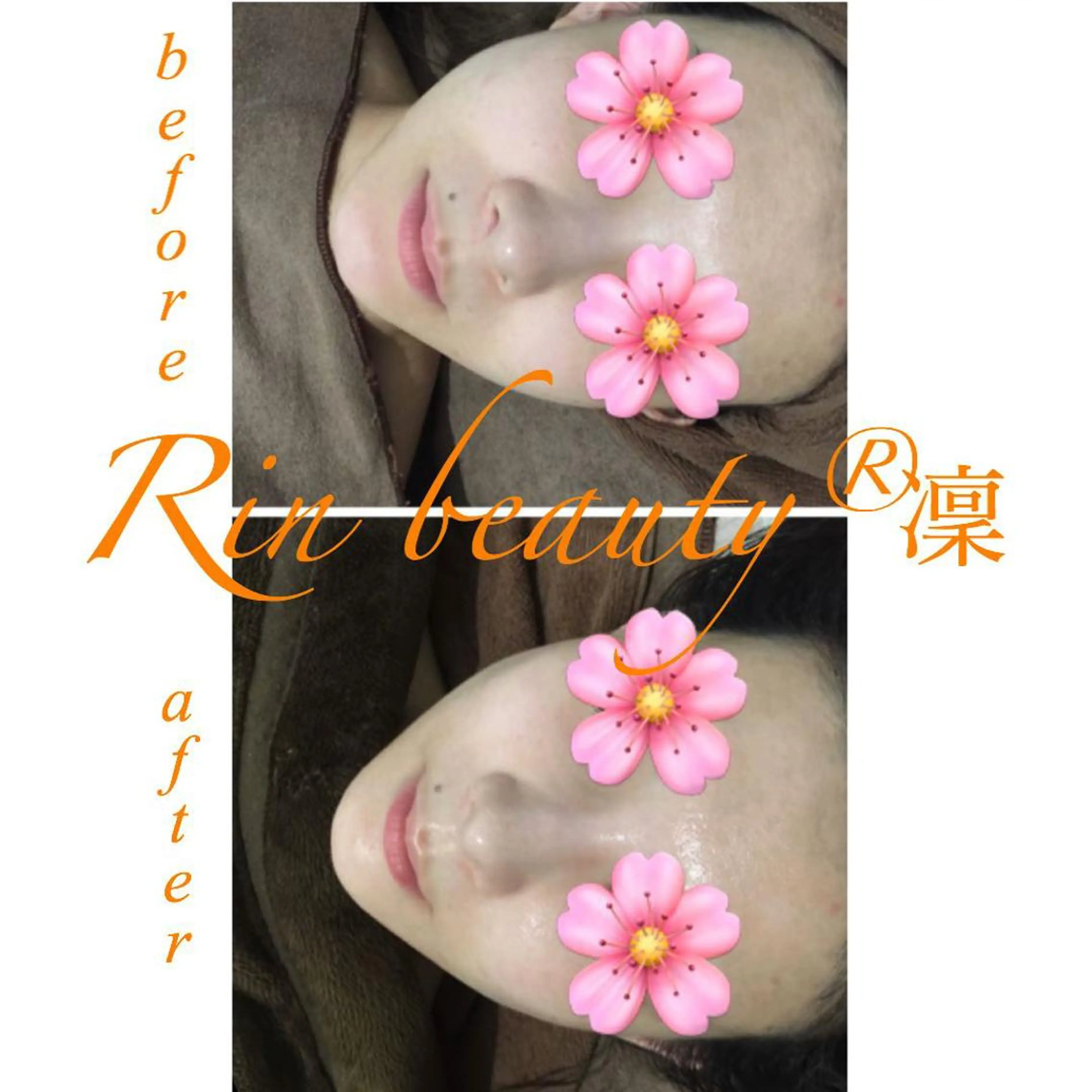 エステ カッピング＆カッサ専門店凜所属・三和 凜のエステ・リラクイメージ