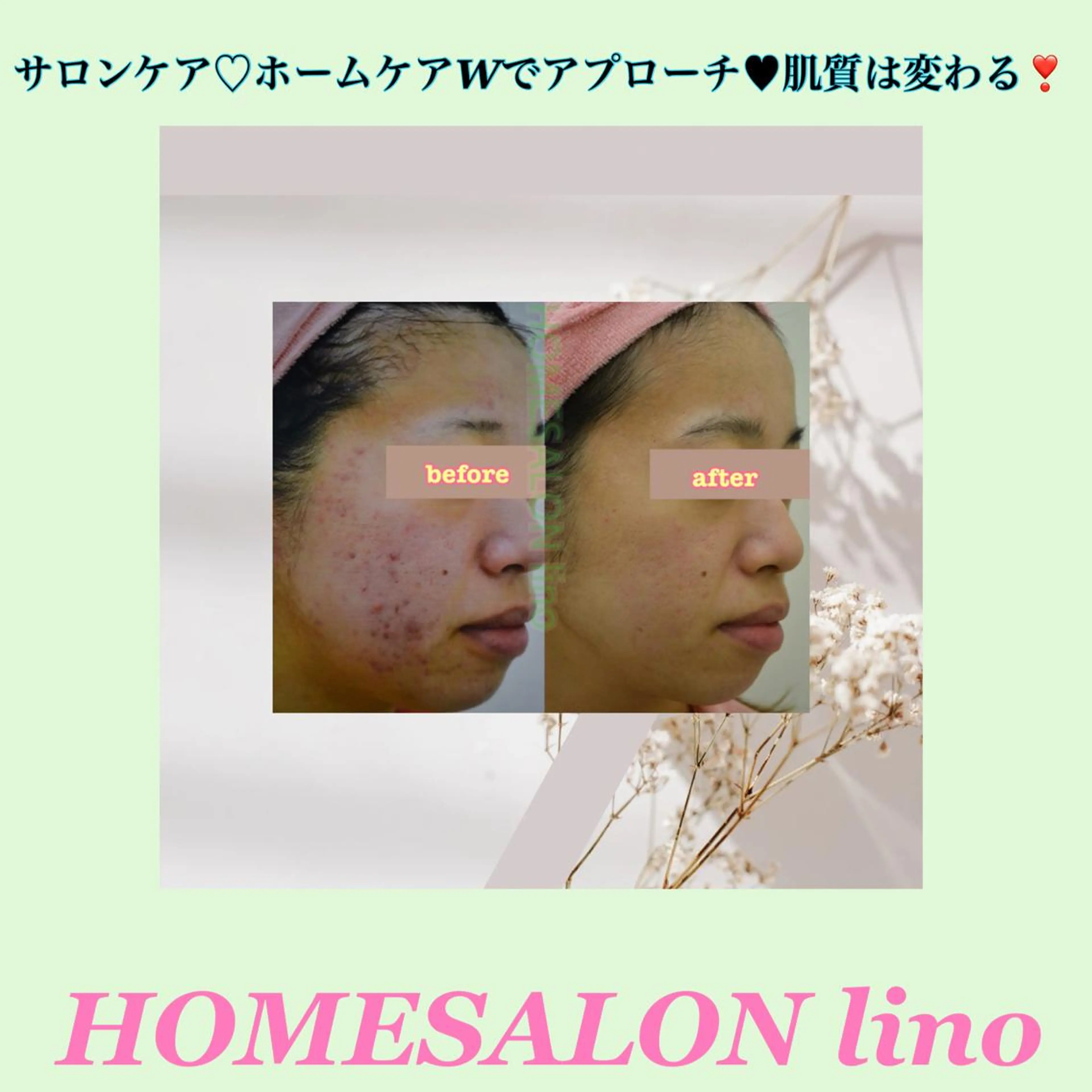 エステ HOME SALON linoのエステ・リラクイメージ