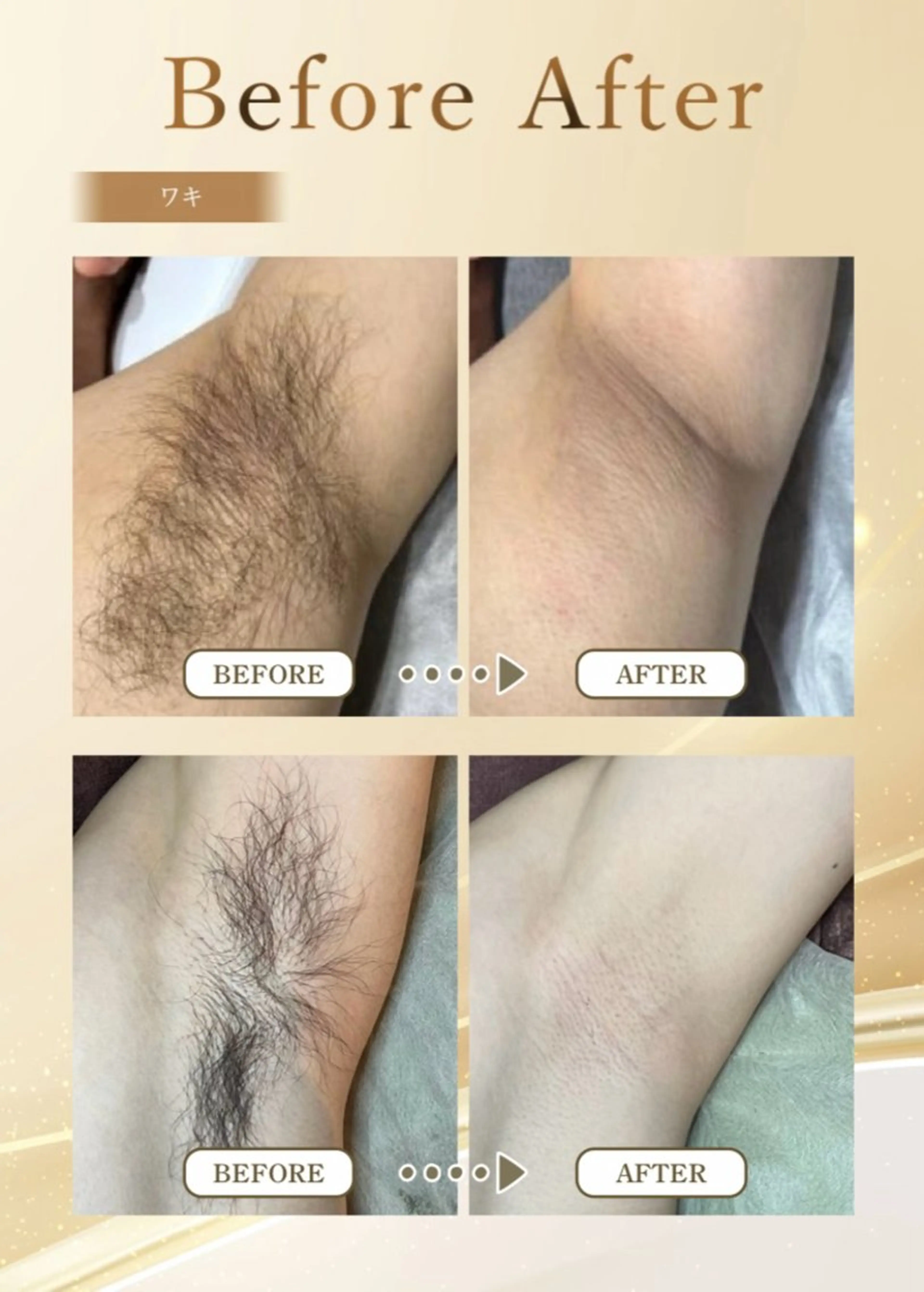 メンズ Ａ&Ｅ所属・西岡 /マツエク/束感🎀のマツエク・マツパデザイン