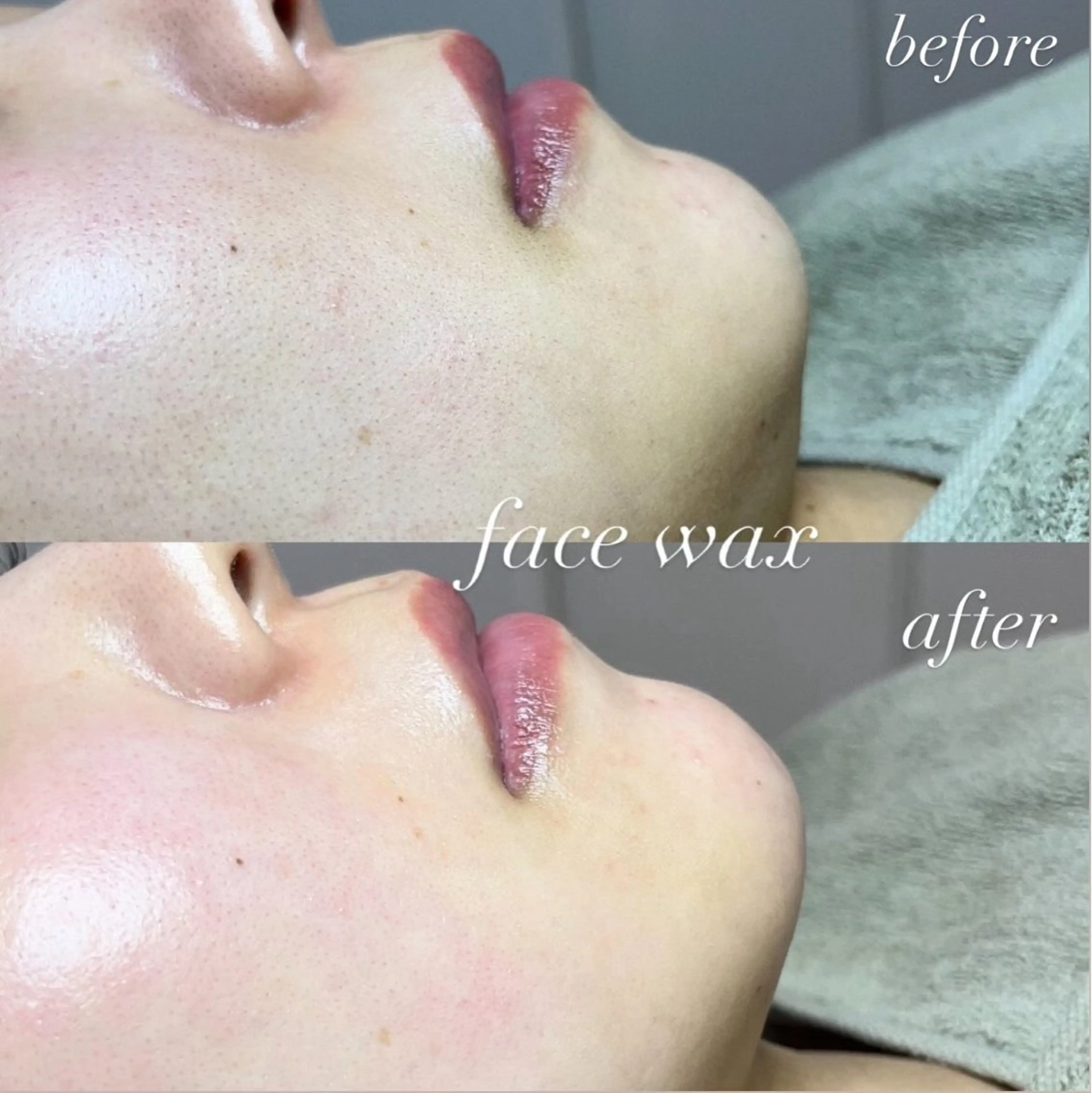 脱毛 beautysalonW所属・beauty salonWのエステ・リラクイメージ