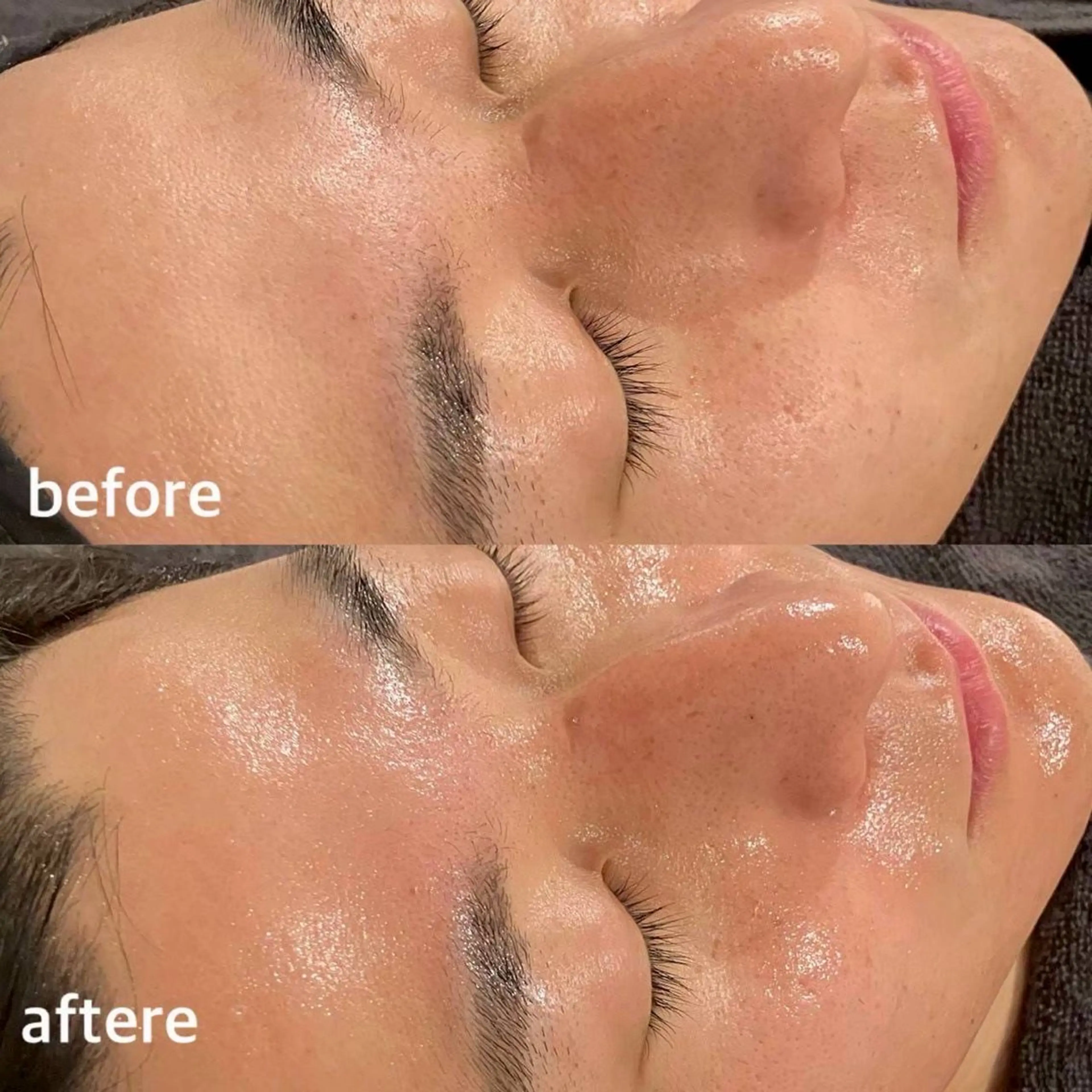 エステ uni. abeのエステ・リラクイメージ