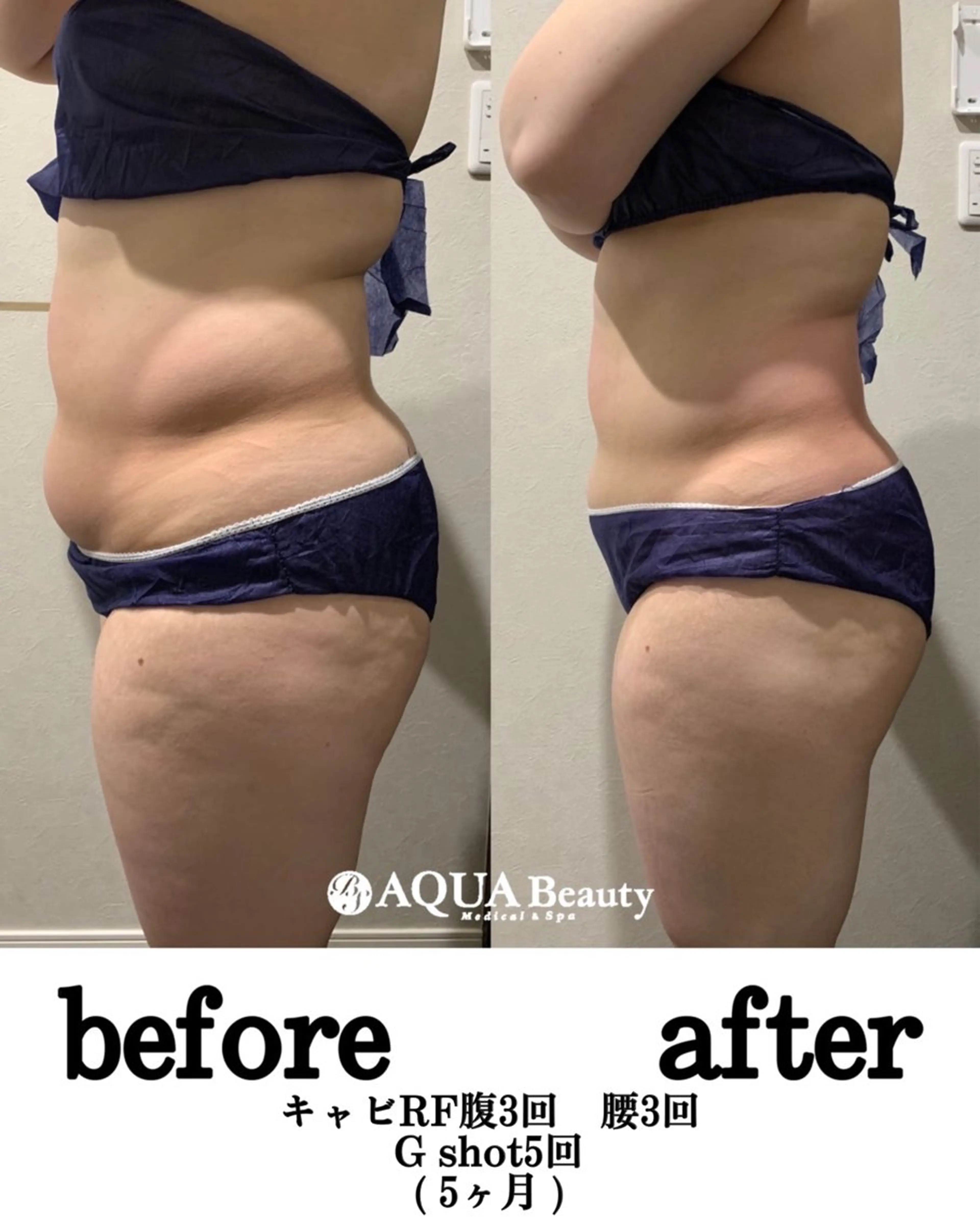 エステ 松島 愛莉のエステ・リラクイメージ