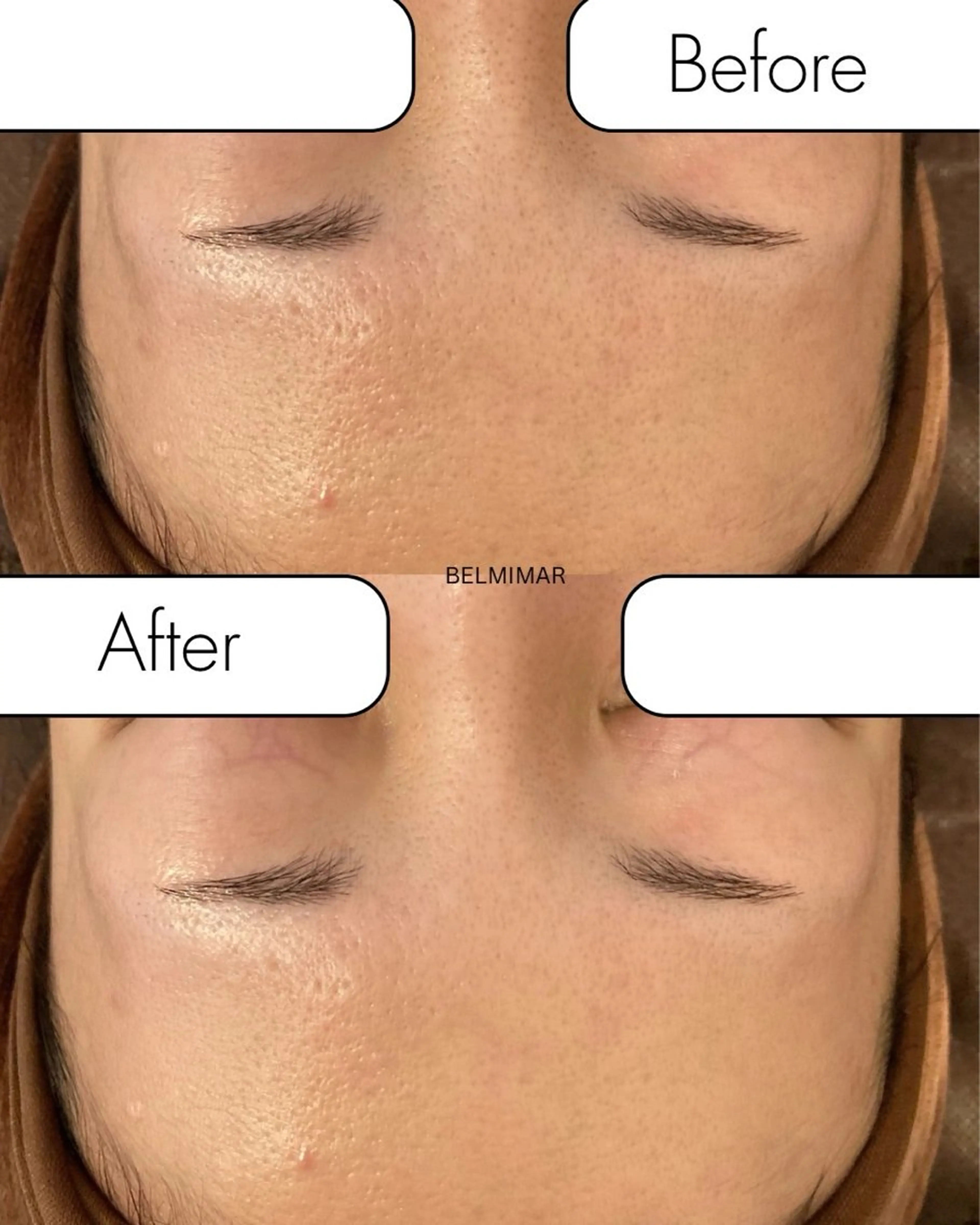 南森町・肌質改善 BELMIMARのエステ・リラクイメージ