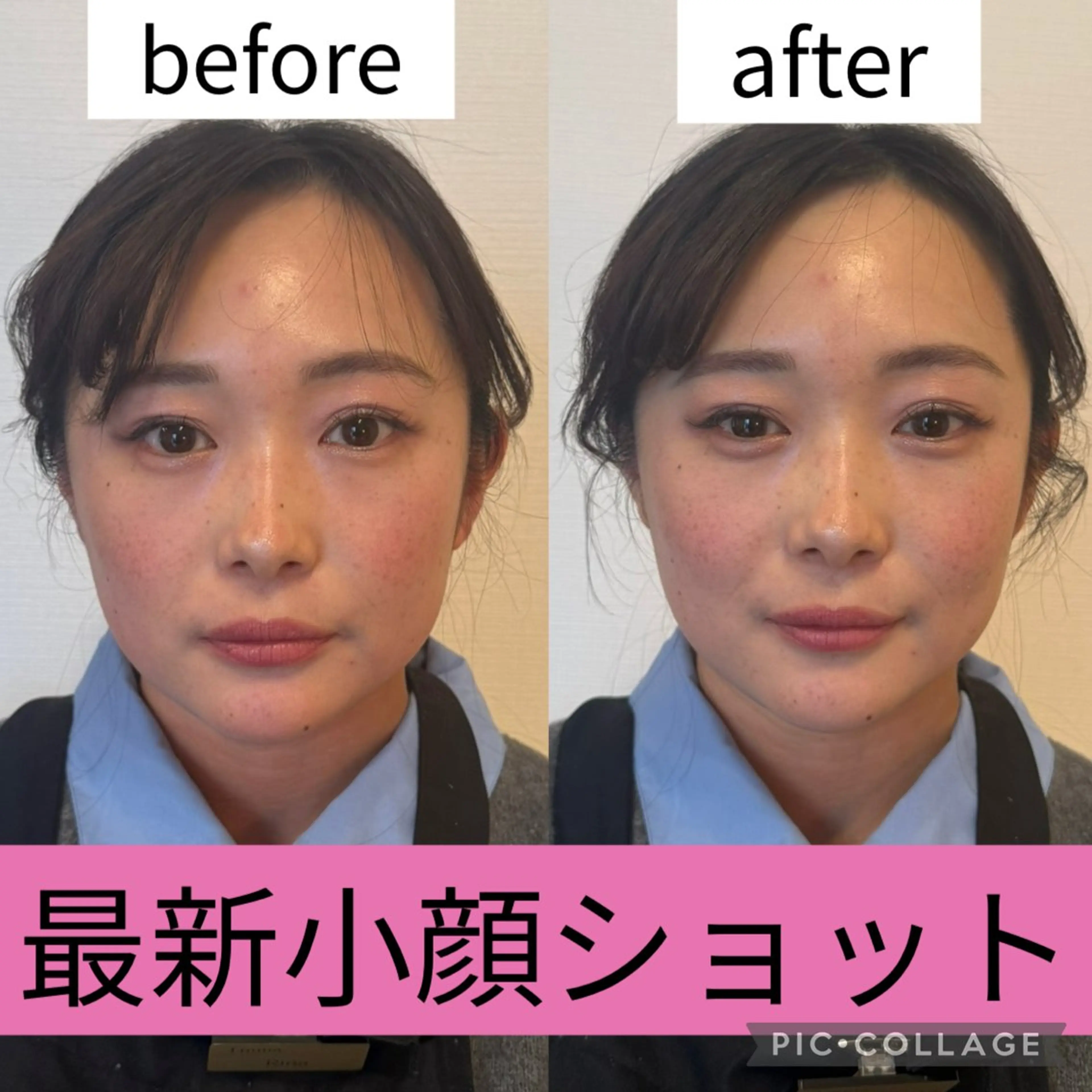 ワックス脱毛 その他(アイブロウ) 眉毛/小顔/ハーブ 🌼hikaruの眉毛・アイブロウイメージ