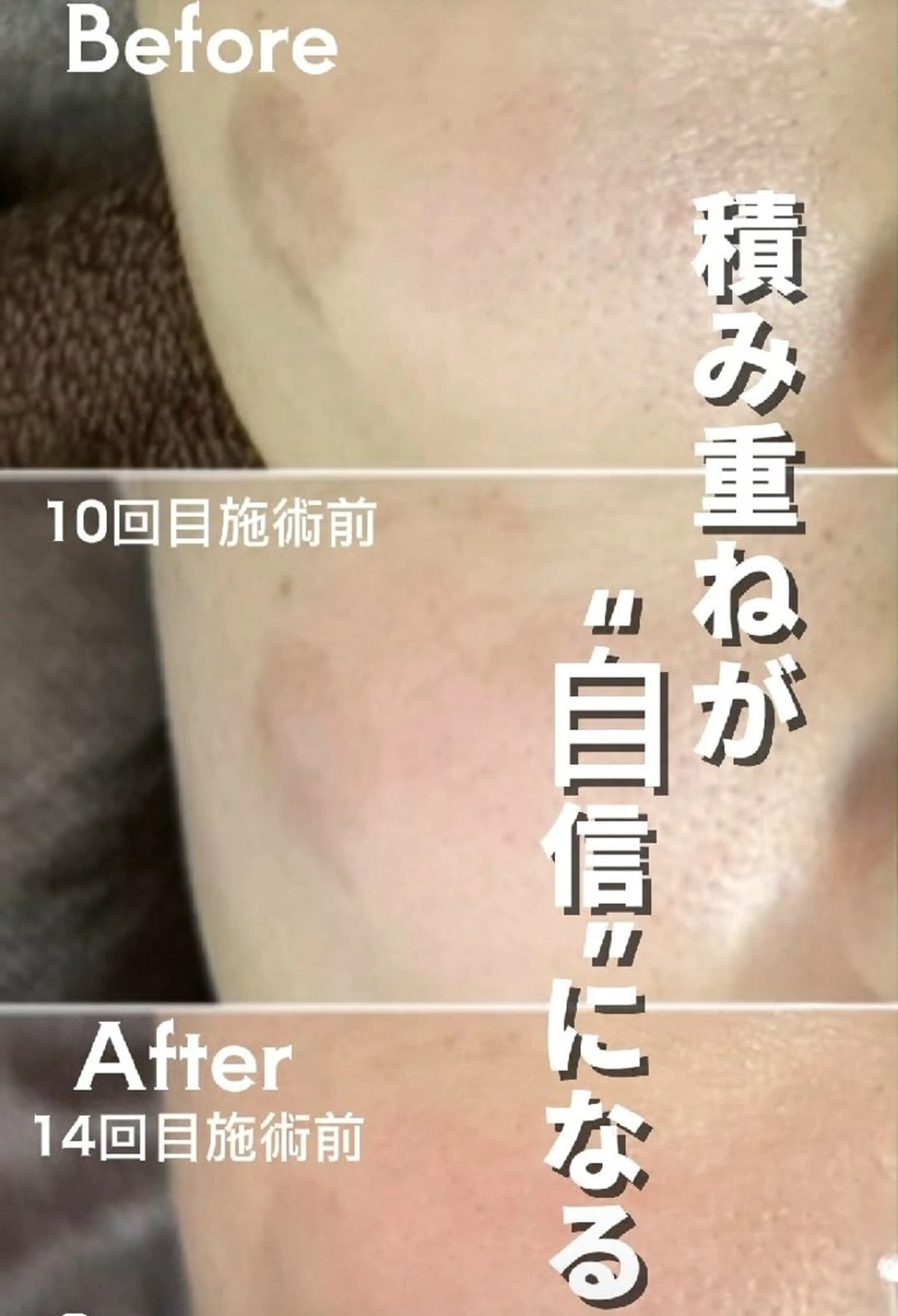 SPOT.com  シミケア専門店のエステ・リラクイメージ